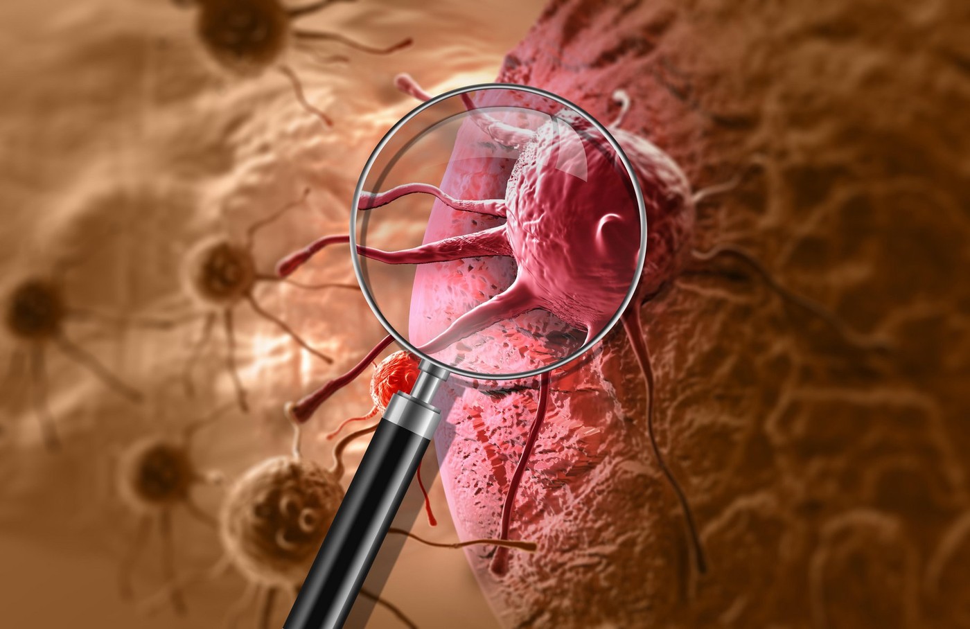 cancer cell made in 3d software,Image: 319208762, License: Rights-managed, Restrictions: , Model Release: no, Credit line: Zoonar GmbH / Alamy / Alamy / Profimedia