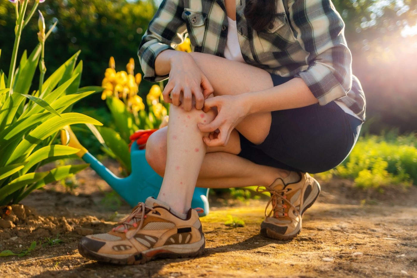 Allergies and insect bites concept. Person scratches her legs, which is itchy from a mosquito bite. Close up. Summer garden on the background.