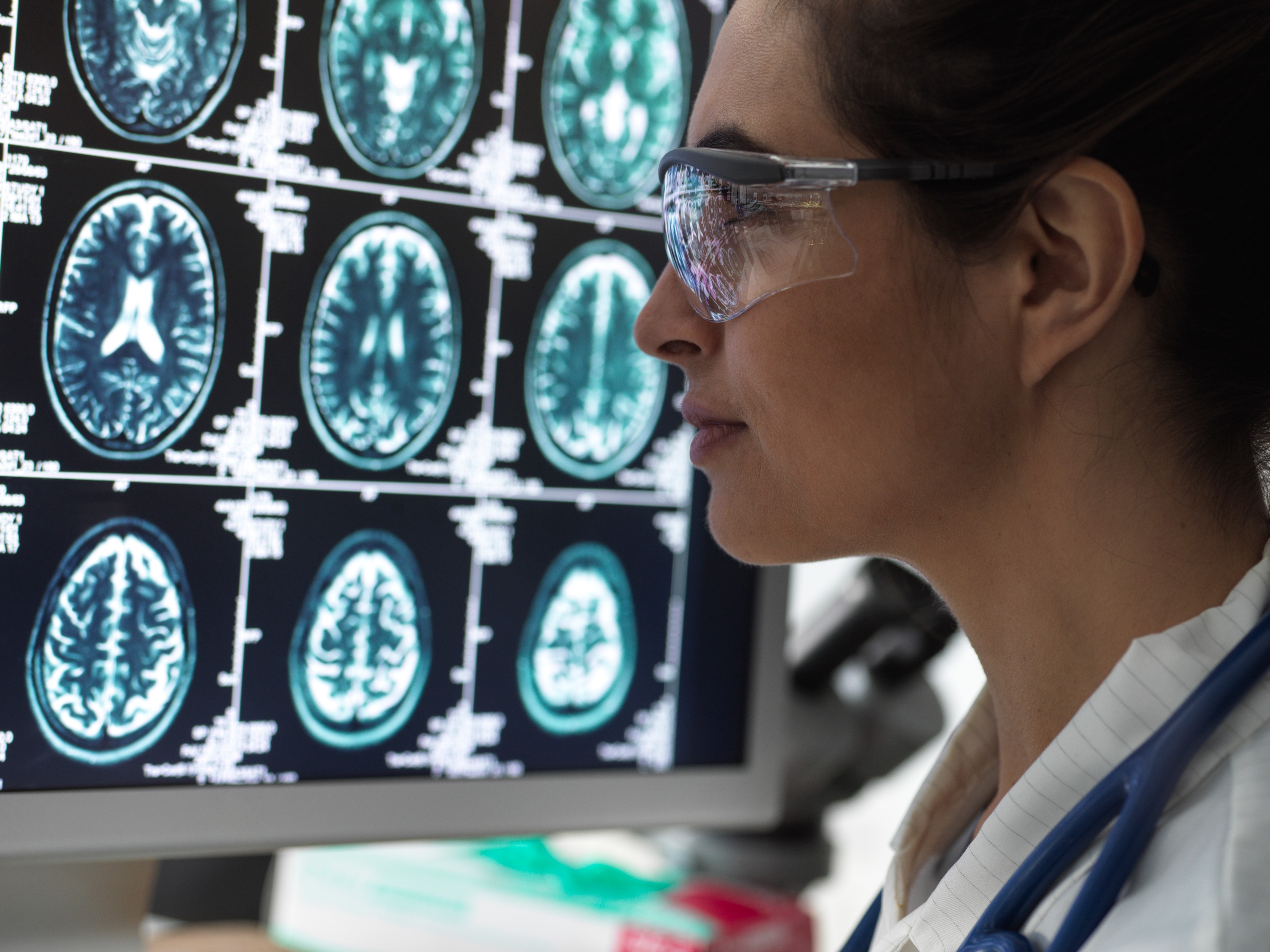 Neurology Diagnosis, Human brain scan on a screen being analyzed by a female doctor in a neurology clinic.