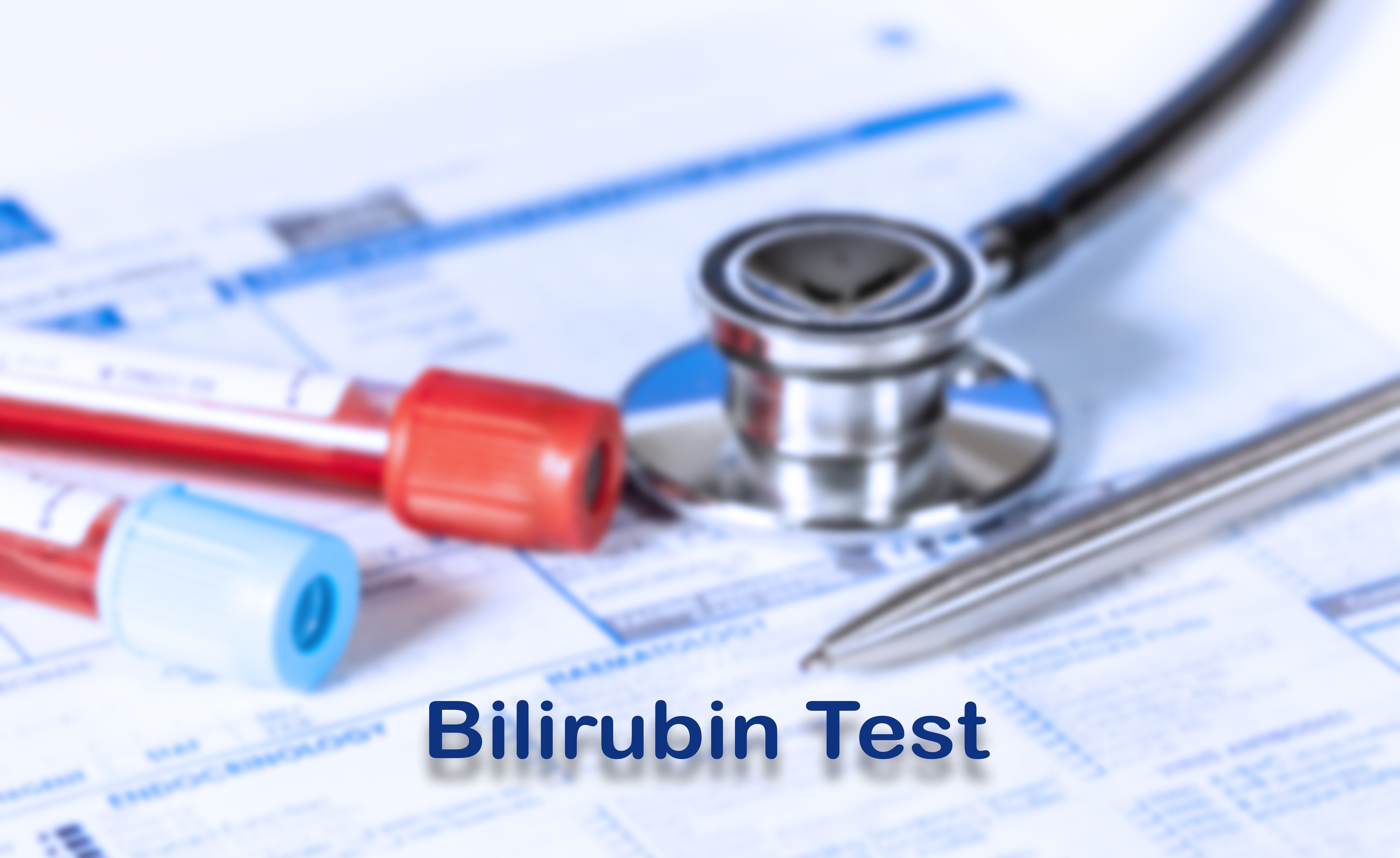 Bilirubin test, conceptual image.,Image: 742952427, License: Royalty-free, Restrictions: , Model Release: no, Credit line: WLADIMIR BULGAR / Sciencephoto / Profimedia