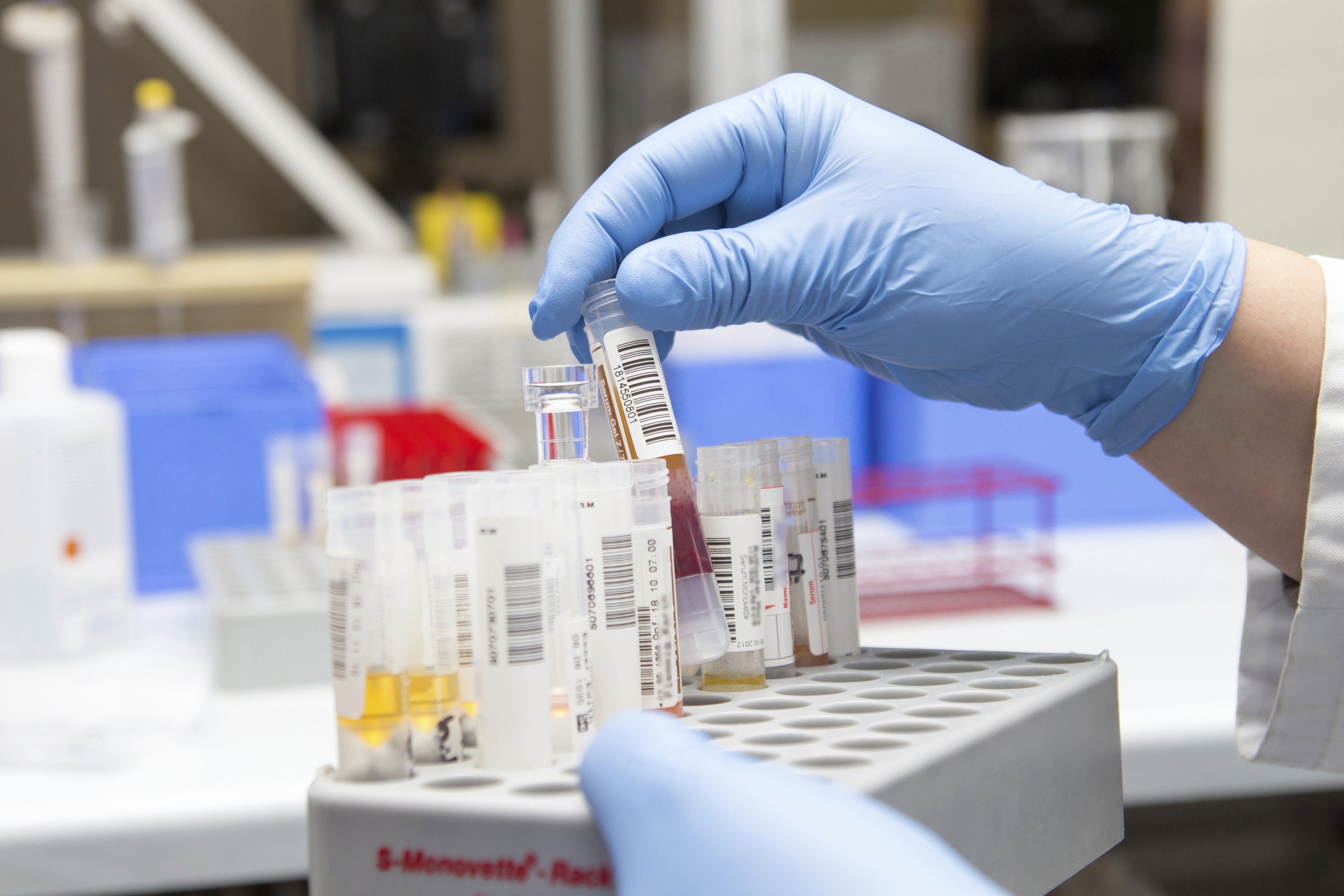 Blood sample analysis