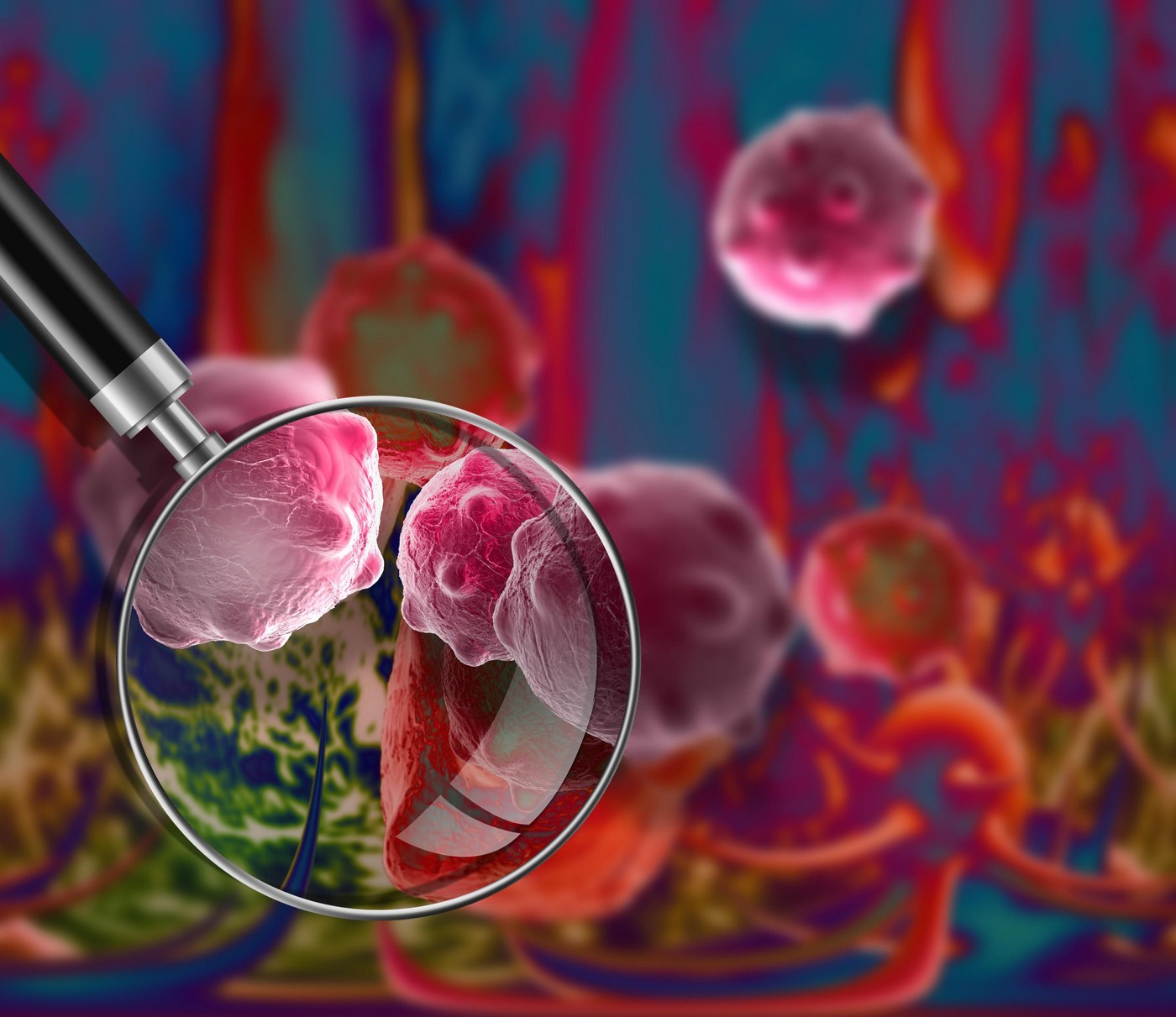 cancer cell made in 3d software,Image: 319032096, License: Rights-managed, Restrictions: , Model Release: no, Credit line: Zoonar GmbH / Alamy / Alamy / Profimedia