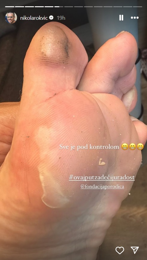 1714303876-nikola-rokvic-stopalo.jpg