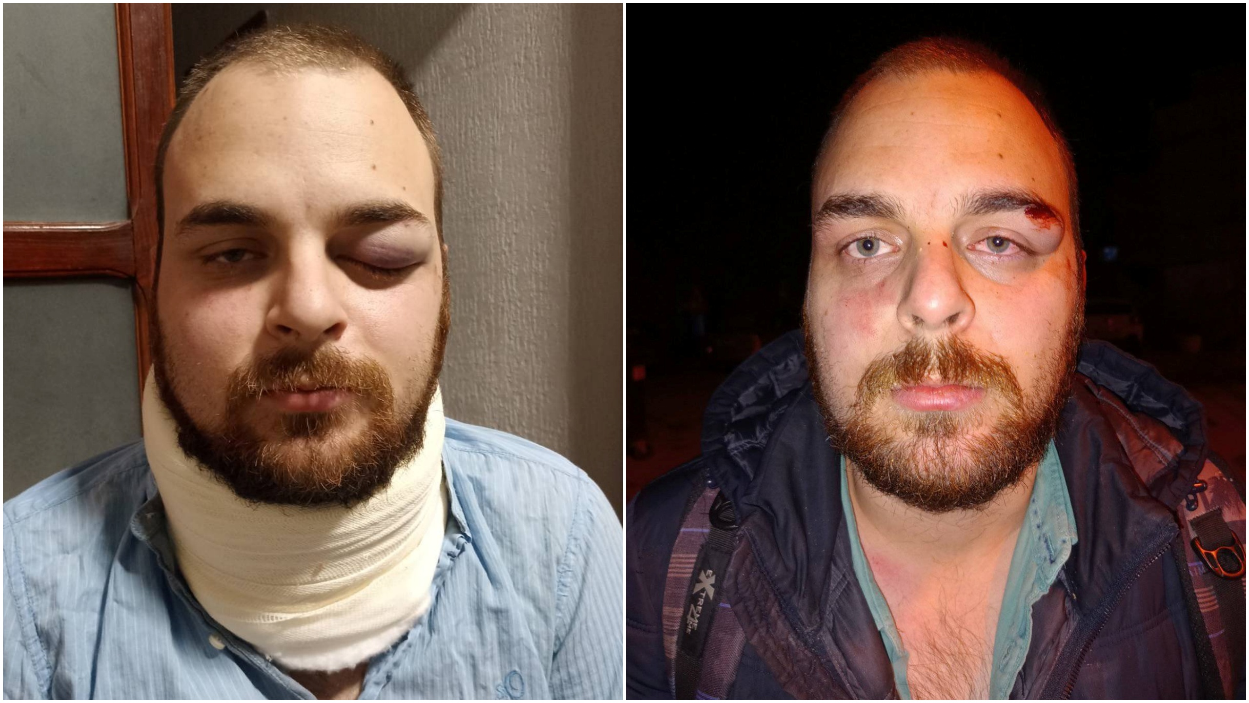 Srđan Đurić, Srdjan Djurić, Novi Sad, napad, kombo  Foto: Zajedno