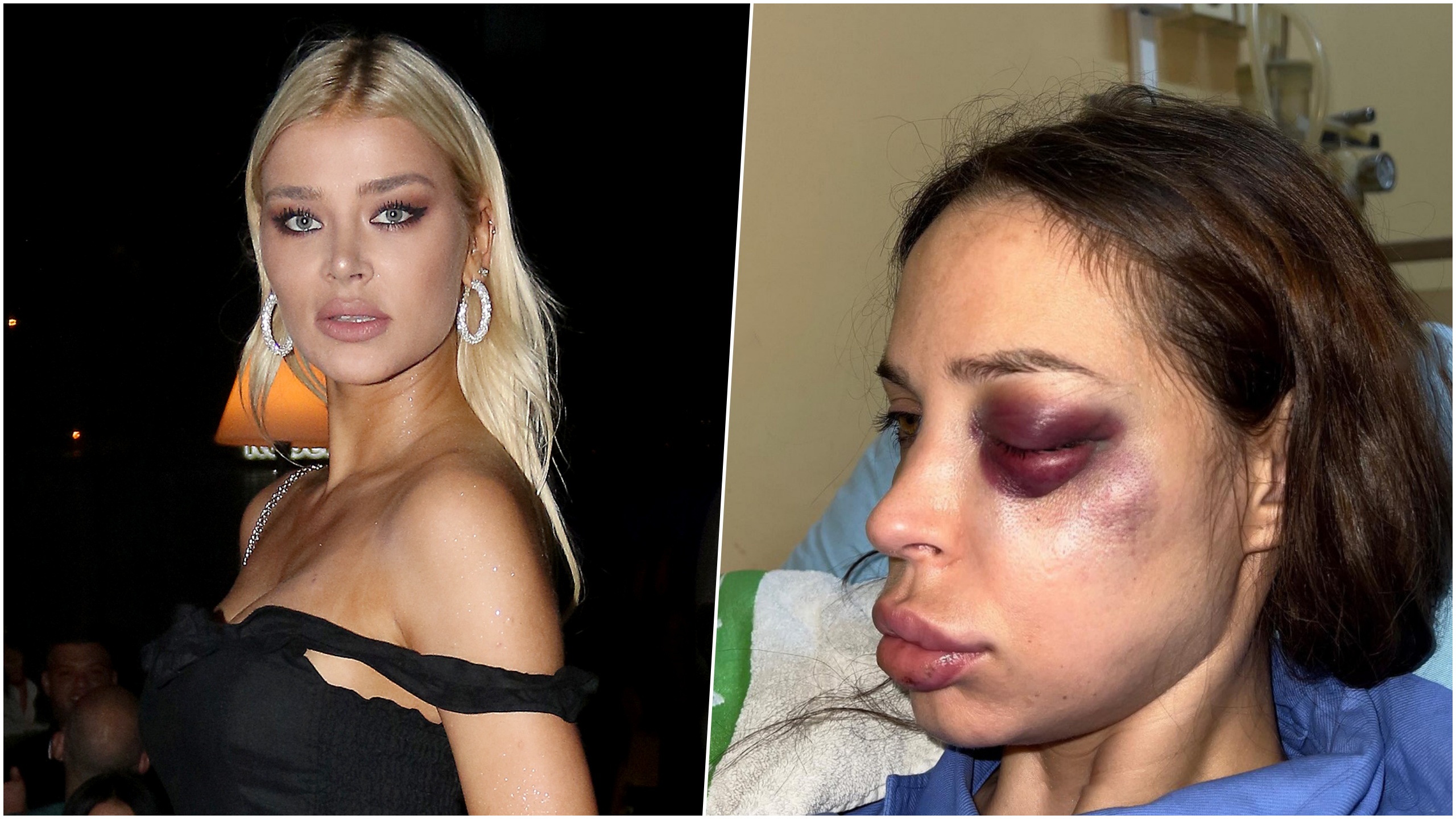 Sofija Milošević i Nataša Šavija kombo