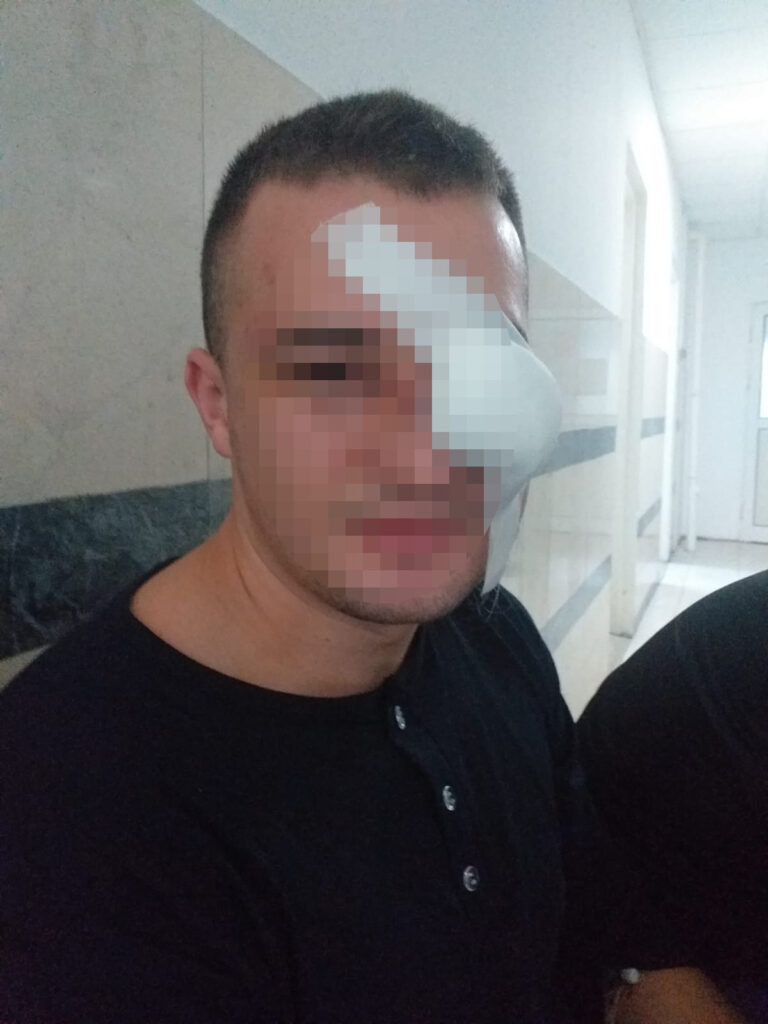 Novi pazar, pretuceni mladic, blur