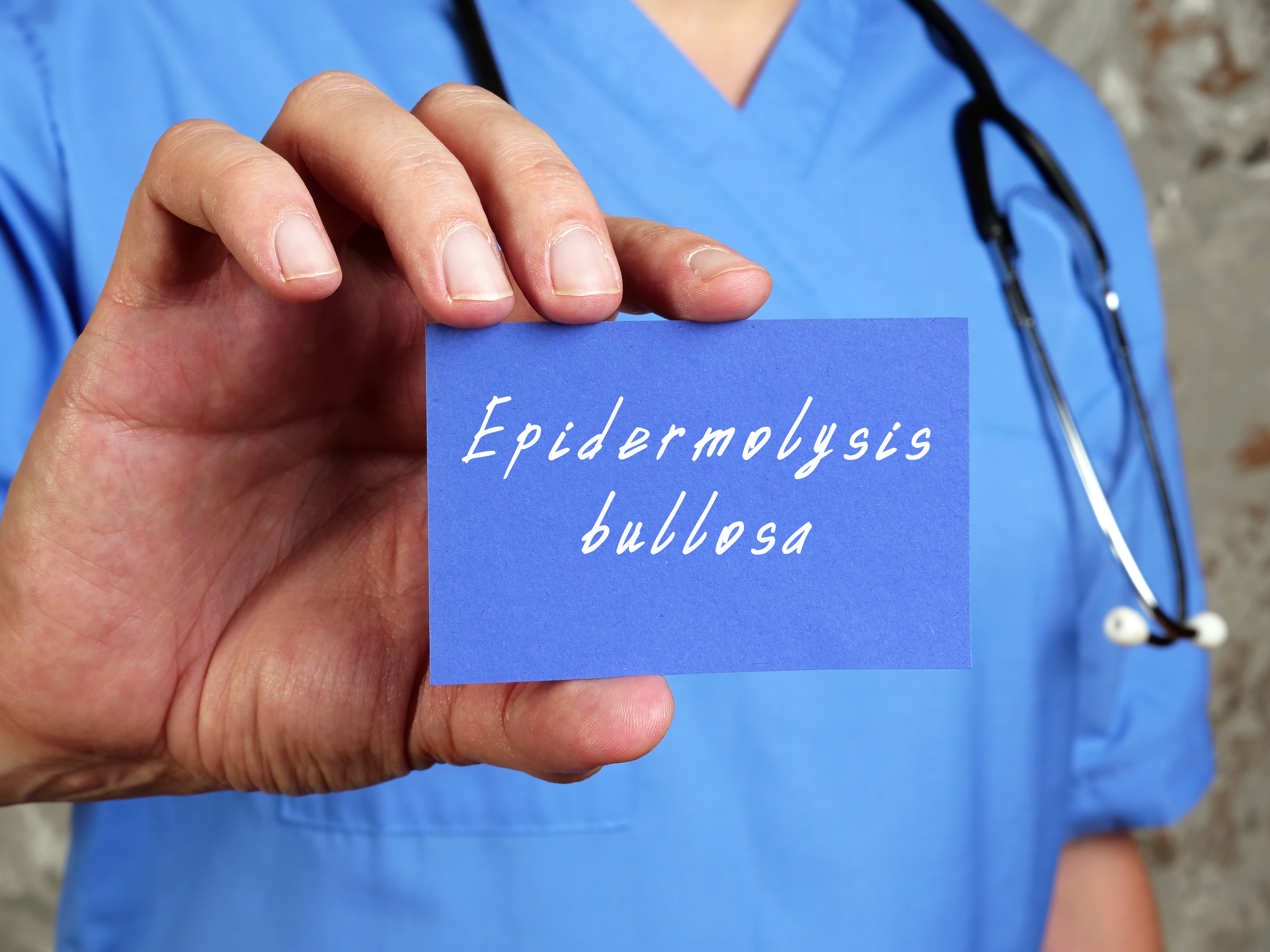Lek za decu leptire, bulozna epidermoliza, lek Foto: Shutterstock