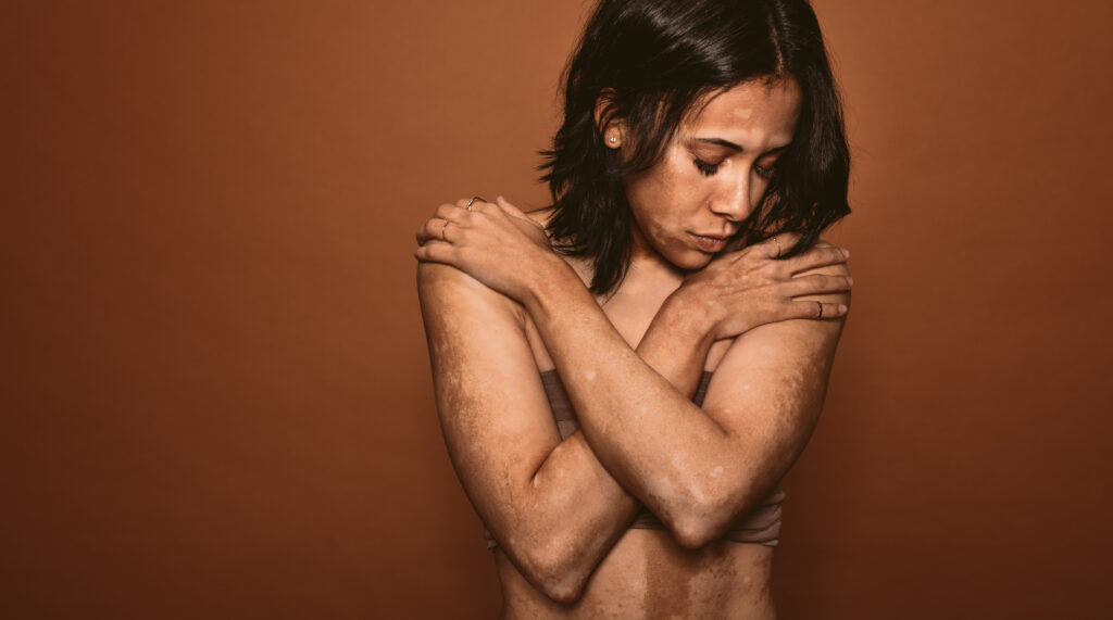 stigma, neprijatnost, neprijatne bolesti