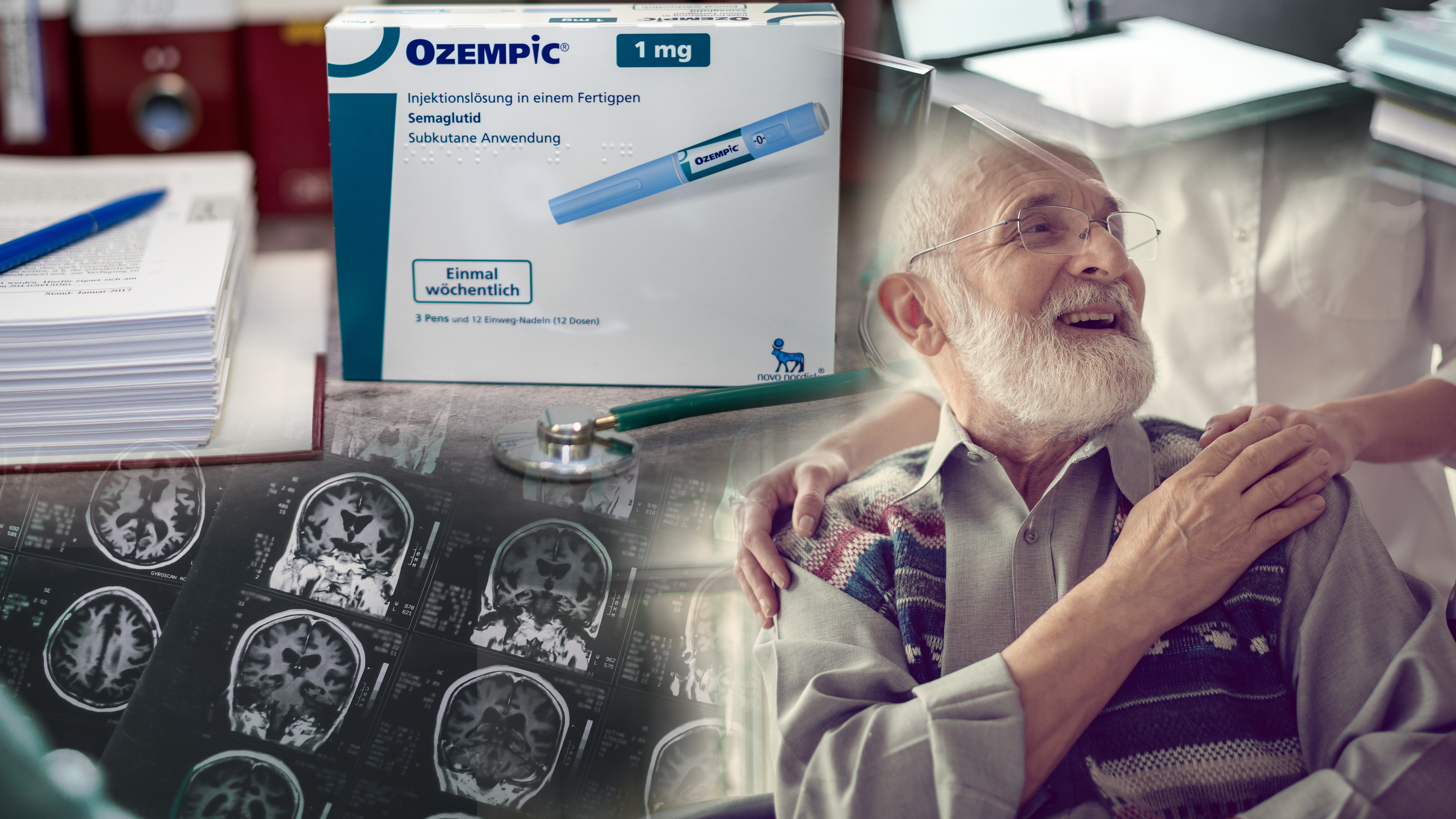 Alzheimer's,Disease,On,Mri