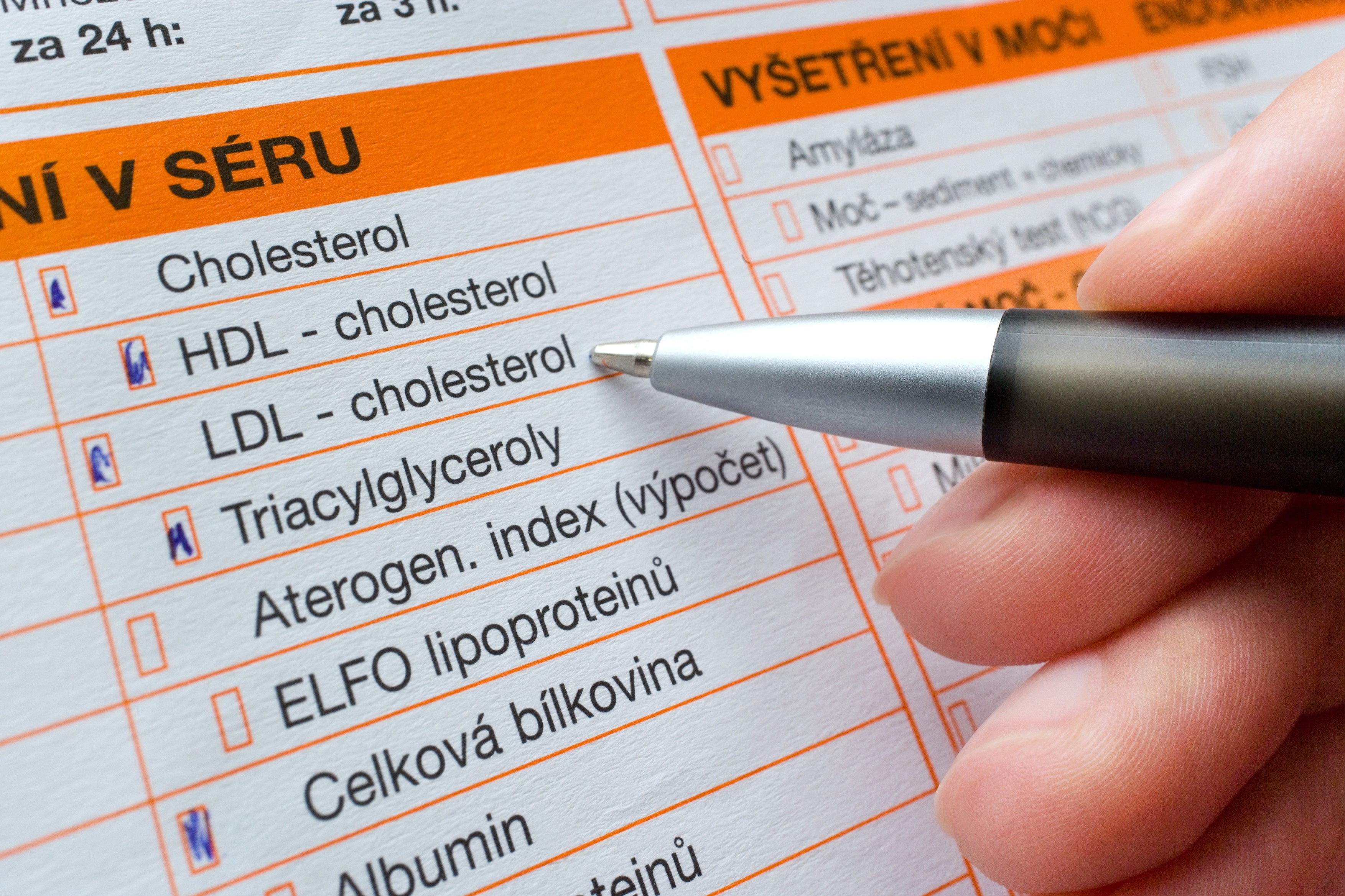 Laboratorni lekarsky rozbor (cesky text) / Lab test