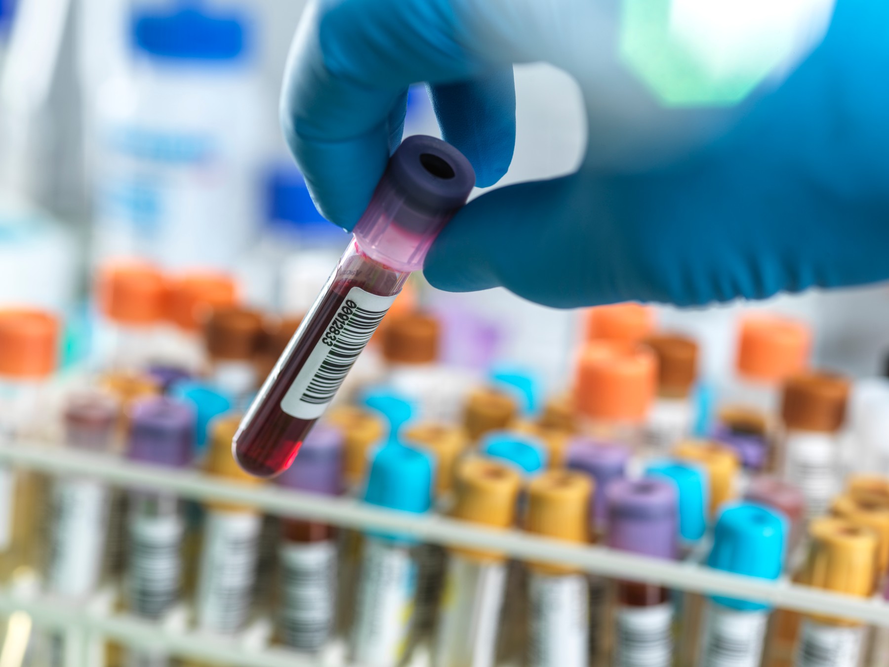 Technician preparing human medical samples for screening in the lab.,Image: 630903739, License: Royalty-free, Restrictions: , Model Release: no, Credit line: TEK IMAGE / Sciencephoto / Profimedia