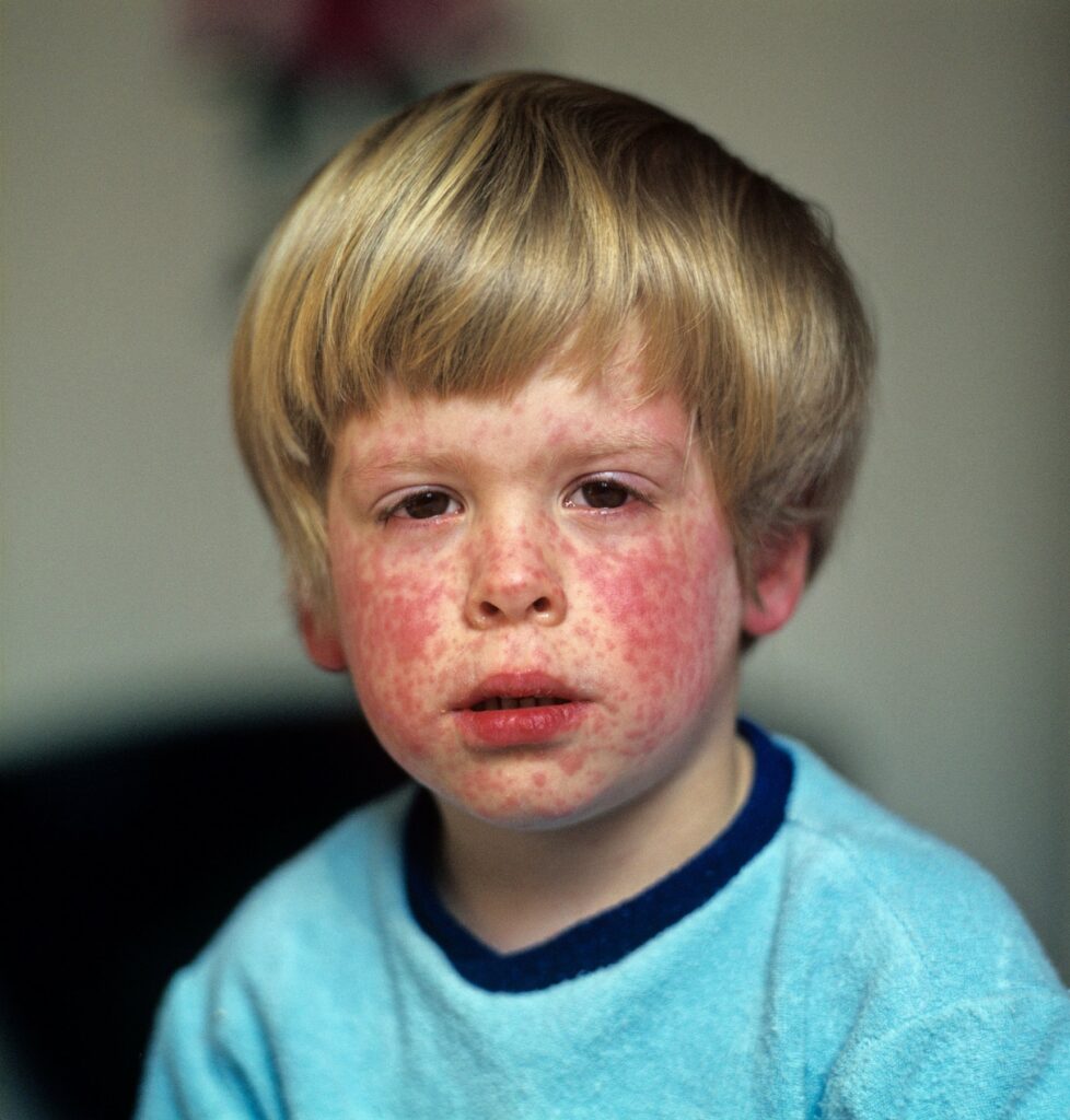 Image: 5286725, License: Rights-managed, Restrictions: , Model Release: no, Credit line: mediacolor's / Alamy / Profimedia