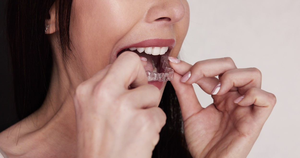 Clear Aligner Dental Night Guard