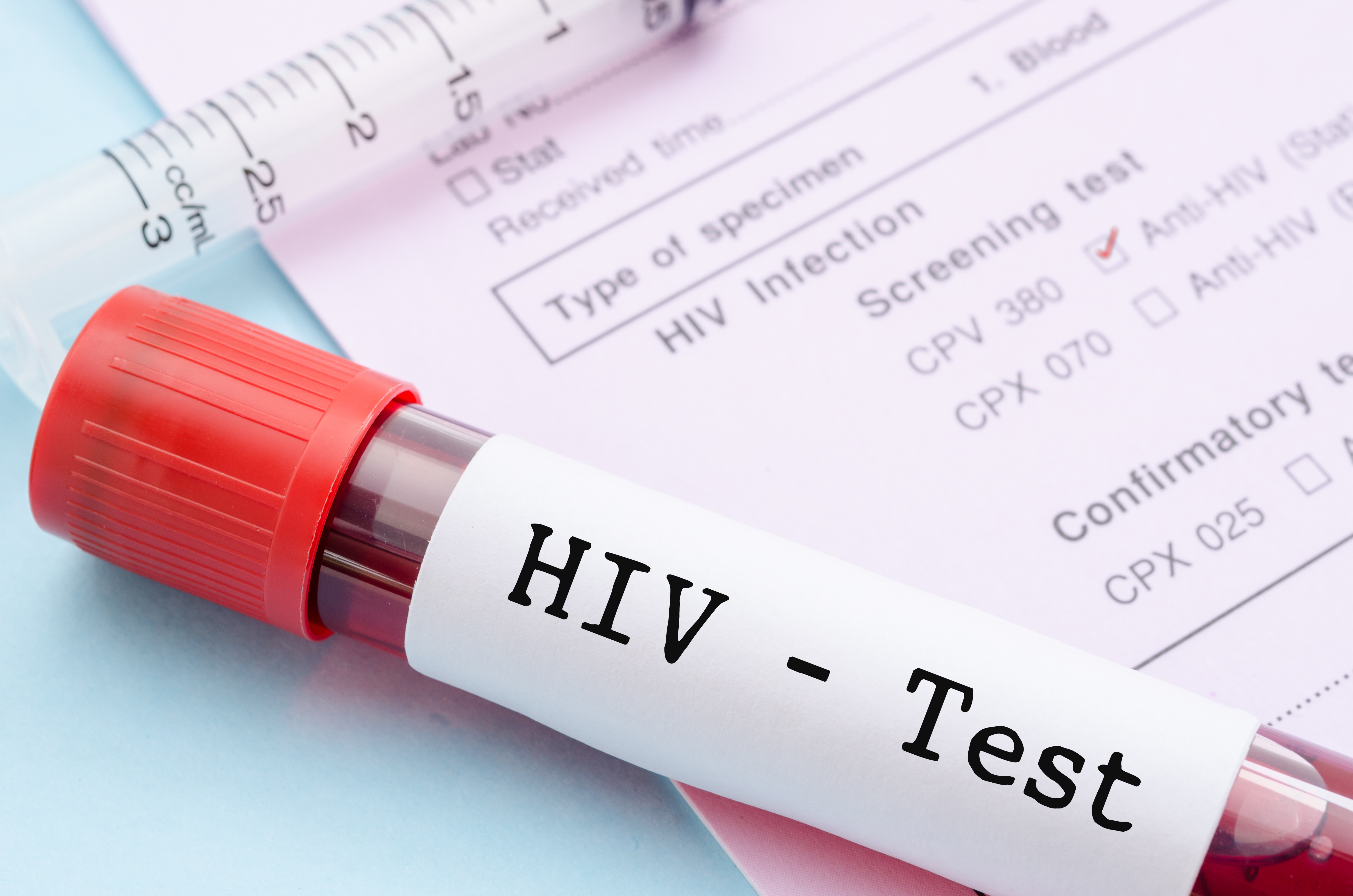 Hiv testiranje hiv test