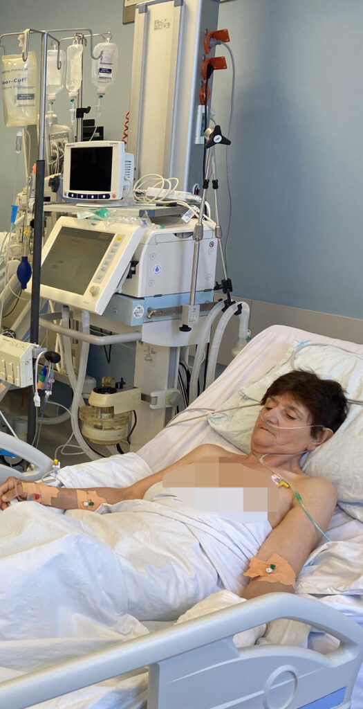 Zlatica Miletić,  transplantacija