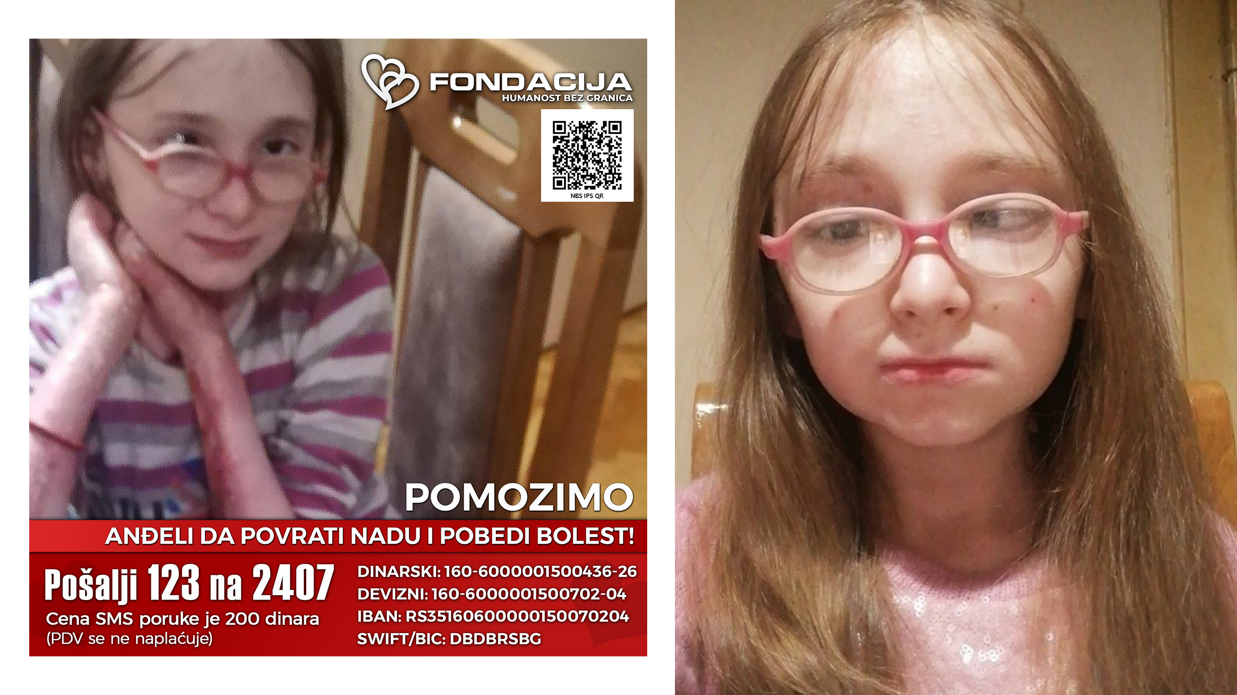 Fondacija humanost bez granica, pomozimo Andjeli