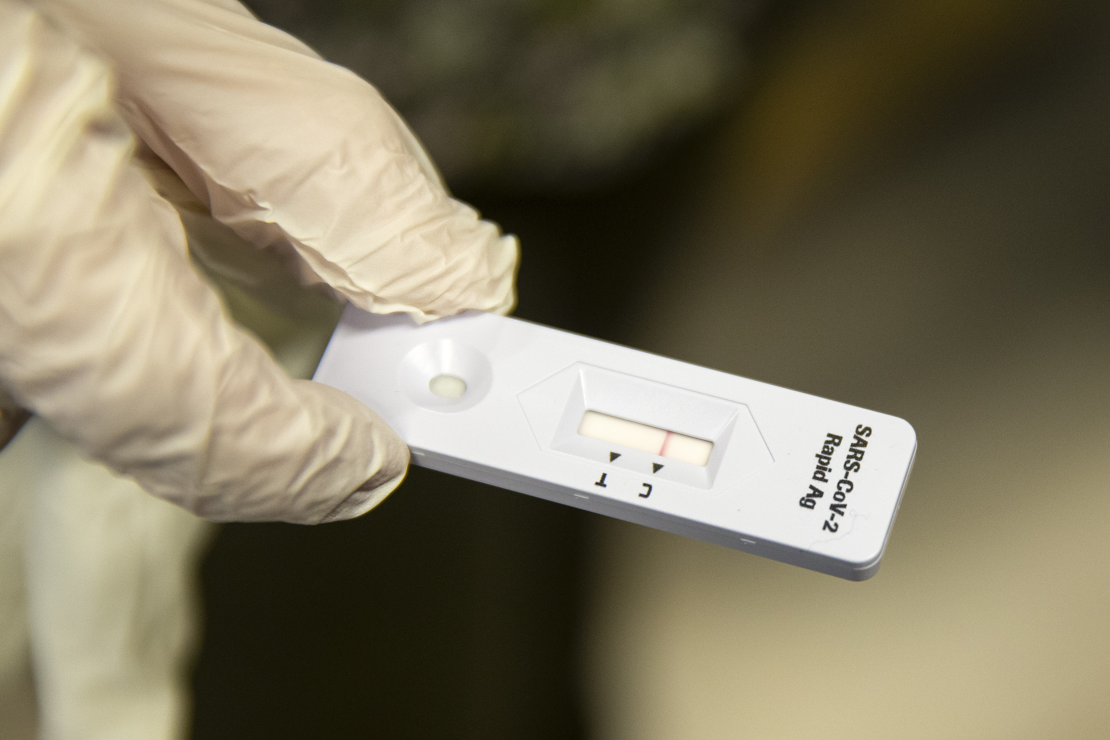 testiranje test koronavirus