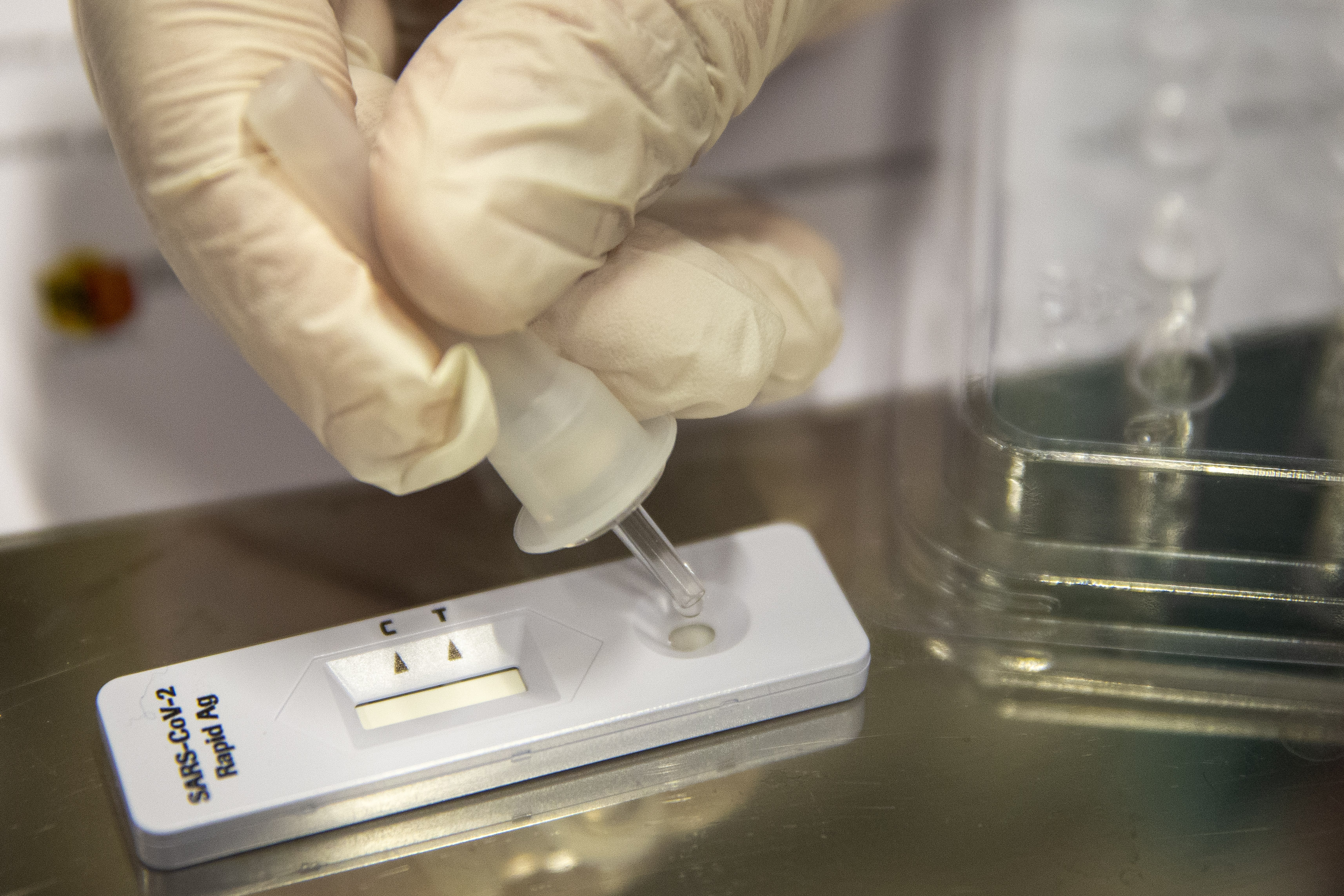 testiranje test koronavirus