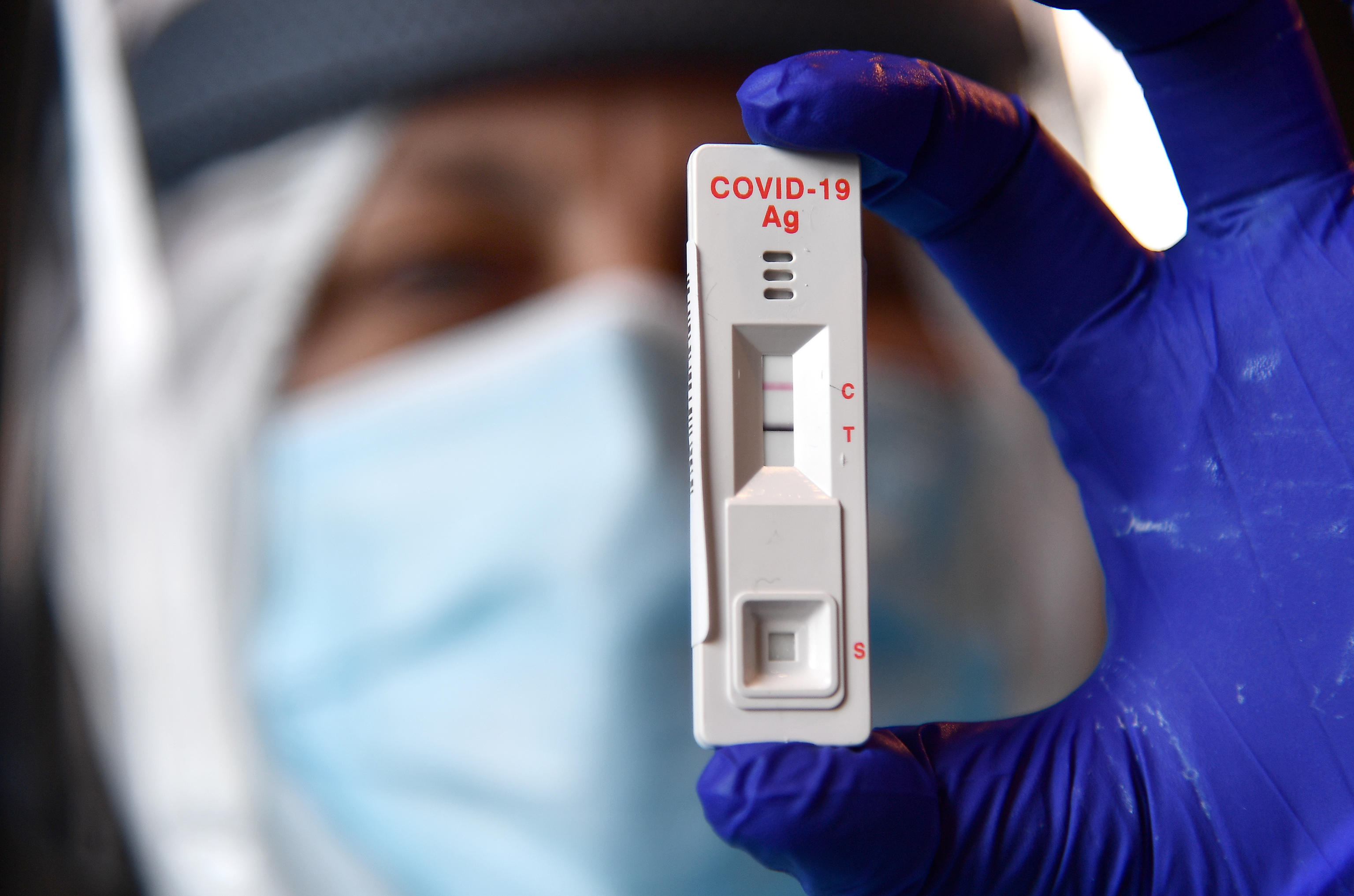 koronavirus test testiranje