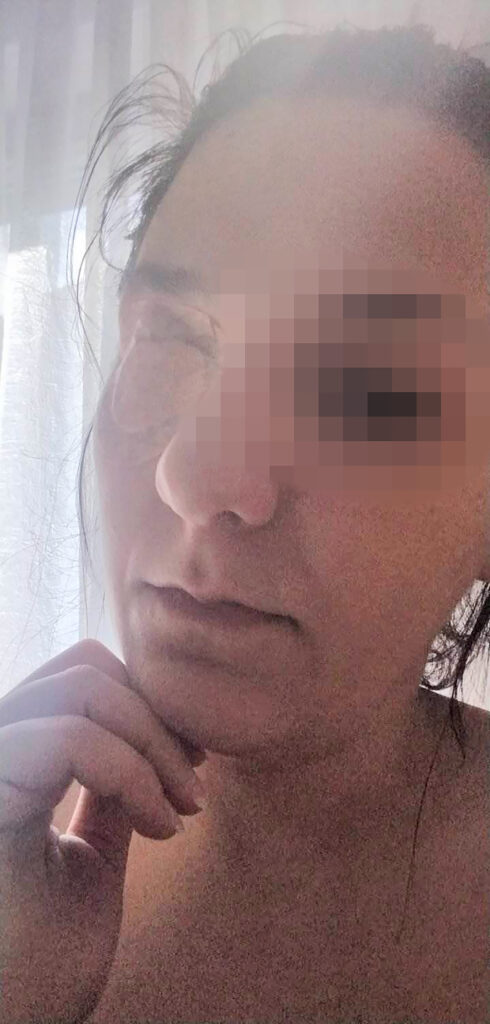 rok trajanja kozmetika, nus pijave opekotine rane