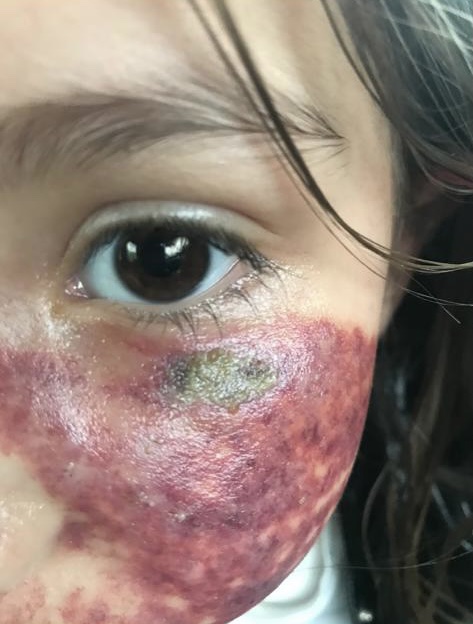 ana markovic poslala..ne blurujemo lice takav je dogovor