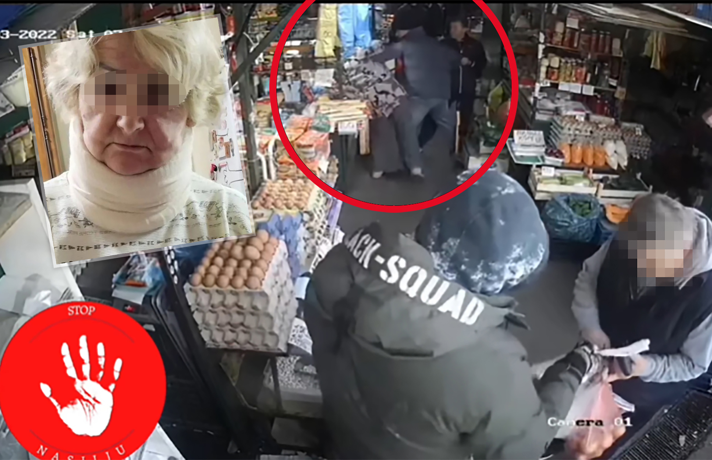 Pijaca na Karaburmi, nasilnik prebija stariju ženu dok ostali gledaju, samo jedan čovek prilazi da pomogne.
Starija žena sa snimka iz Karaburme, prethodna objava, na slikama vam se nalazi lekarski izveštaj, kao rengenski snimci povreda.