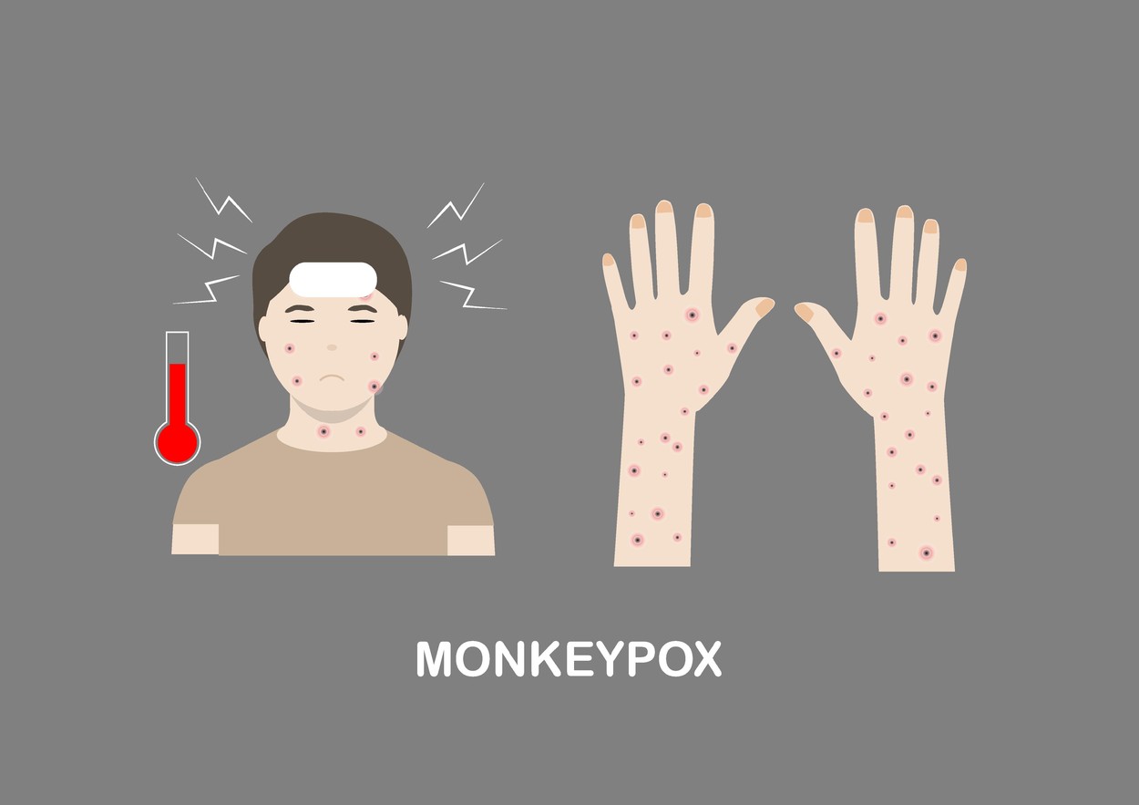 Image: 694638648, License: Royalty-free, Restrictions: , Model Release: no, Credit line: srikijt / Alamy / Alamy / Profimedia