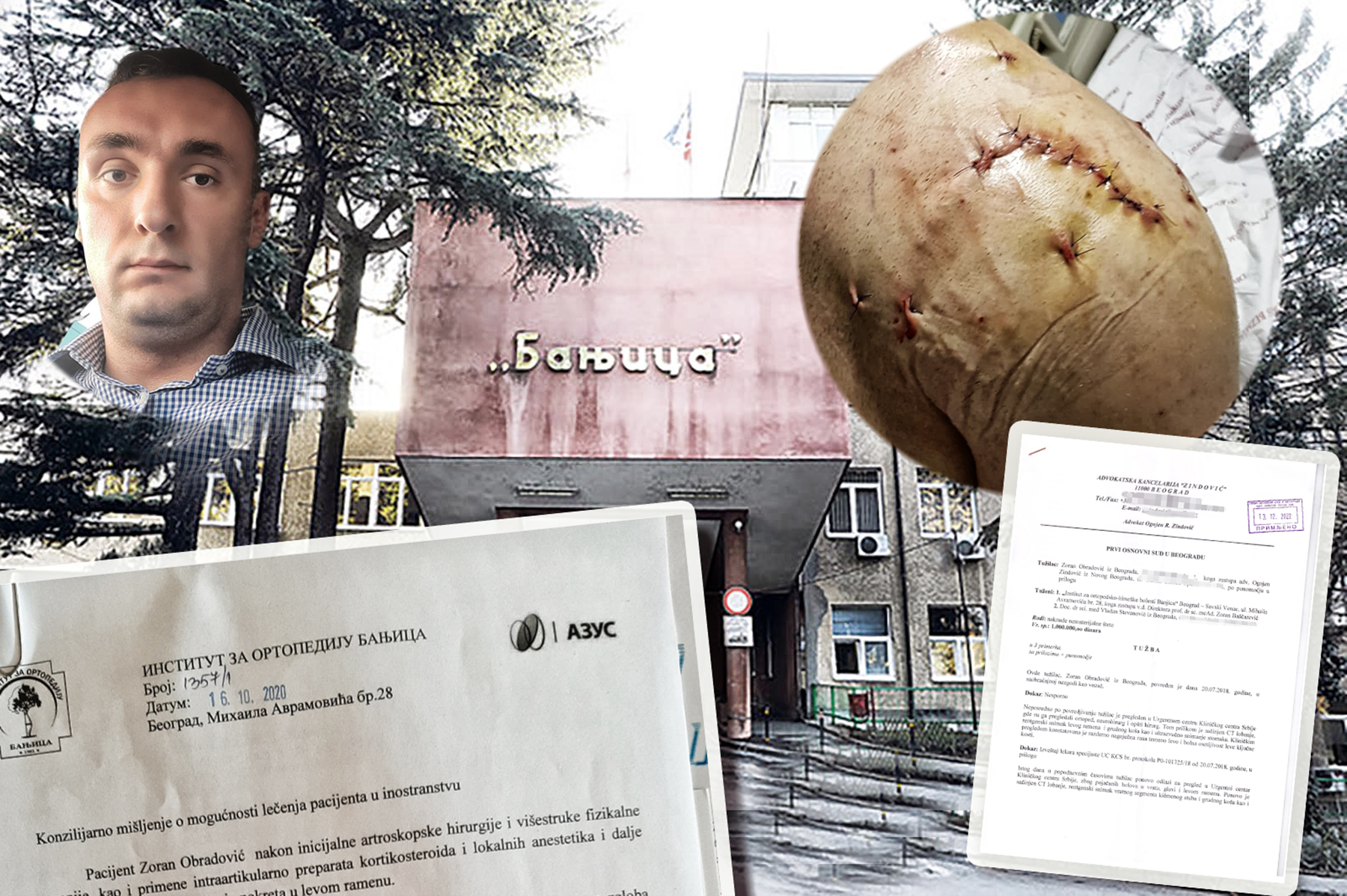 Zoran Obradović operacija povredjeno rame banjica ortopedija