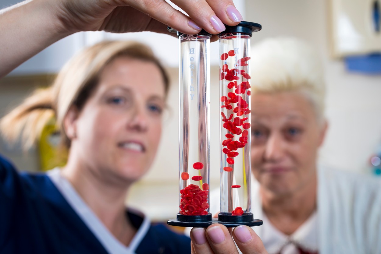 Diabetes education, blood viscosity