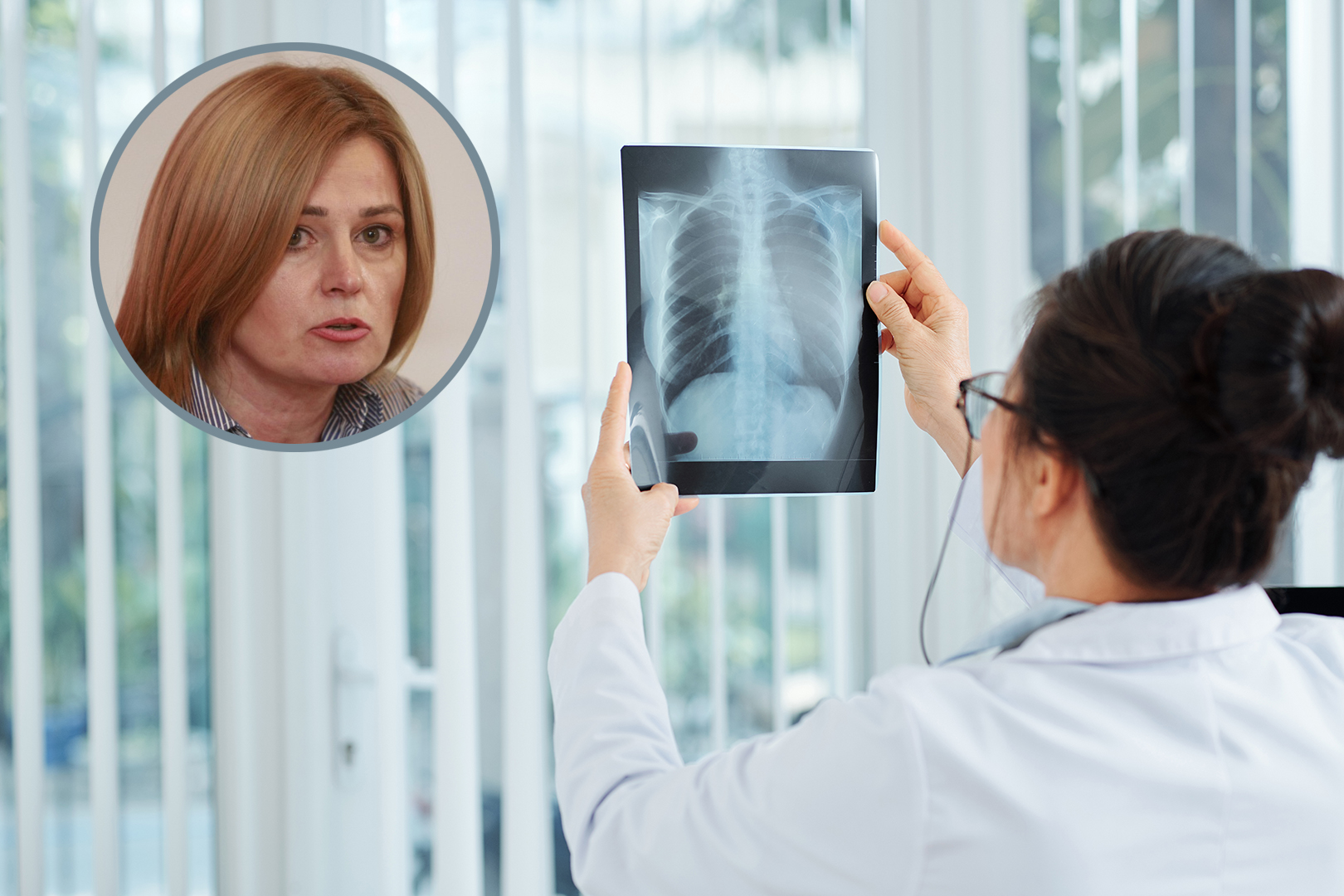 Doctor checking lungs x-ray of patient with lung inflammation indicating the presence of pneumonia Dr Ljiljana Timotijević Foto: Press centar UNS