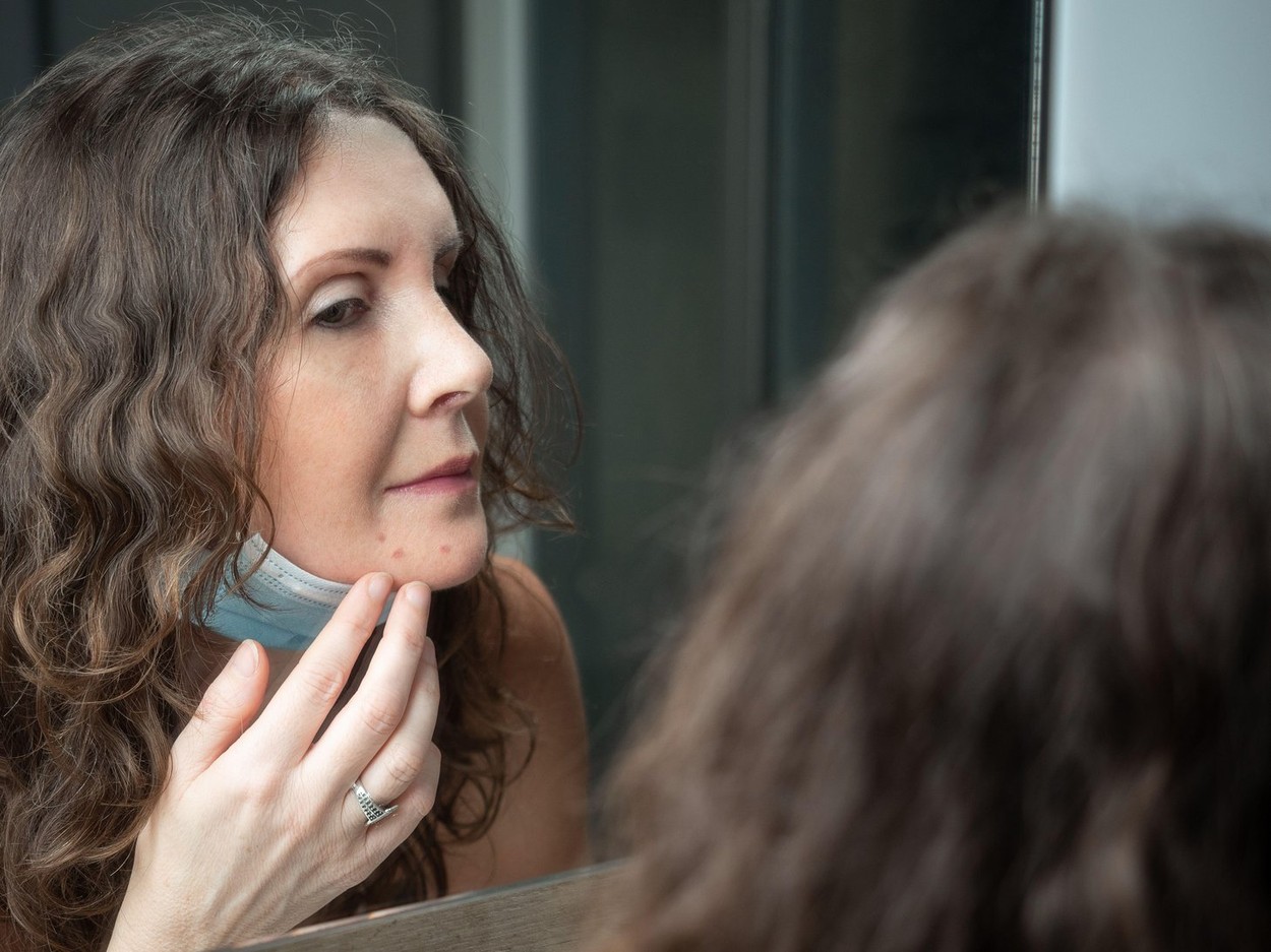 Middle-aged caucasian woman suffering with acne on her chin after wearing protective face mask. Looking at mirror.,Image: 567785064, License: Royalty-free, Restrictions: , Model Release: no, Credit line: Jana Kollarova / Alamy / Alamy / Profimedia