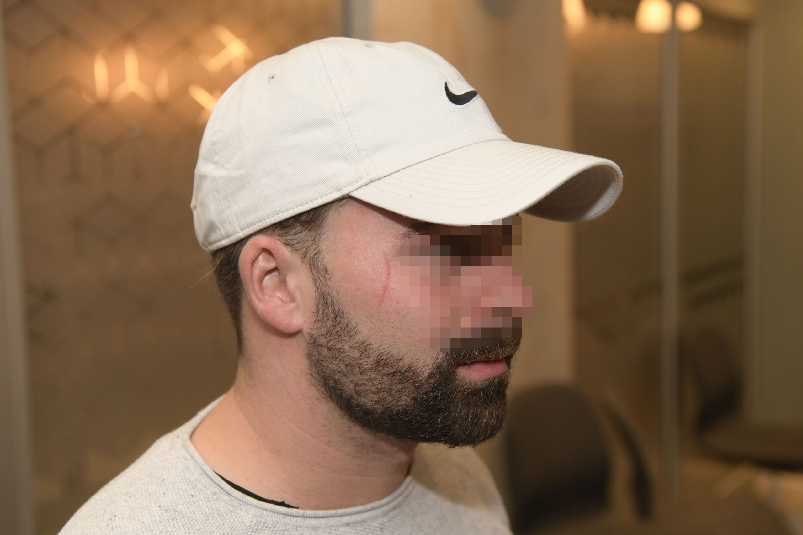 Beograd 17. oktobar 2022. Pretuceni Svajcarci na splavu Kafana na vodi. Svajcarski drzavljani pretuceni u nocnom izlasku prilikom poseti Beogradu, medicinska dokumentacija iz Urgentnog centra Foto:Goran Srdanov