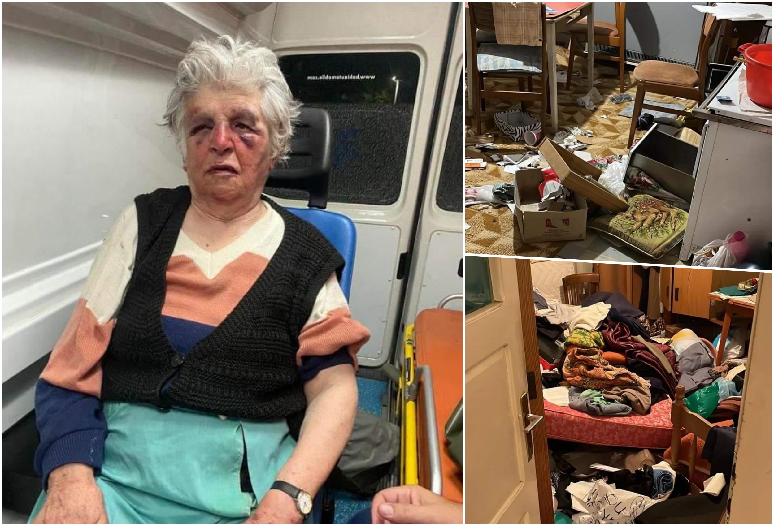 Pretucena baba Božana R. (84) iz Severne Mitrovice oporavlja se na odeljenju intenzivne nege u bolnici u Severnoj Mitrovici, nakon što su je brutalno pretukla dvojica maskiranih napadača koji su pokušali da je opljačkaju.