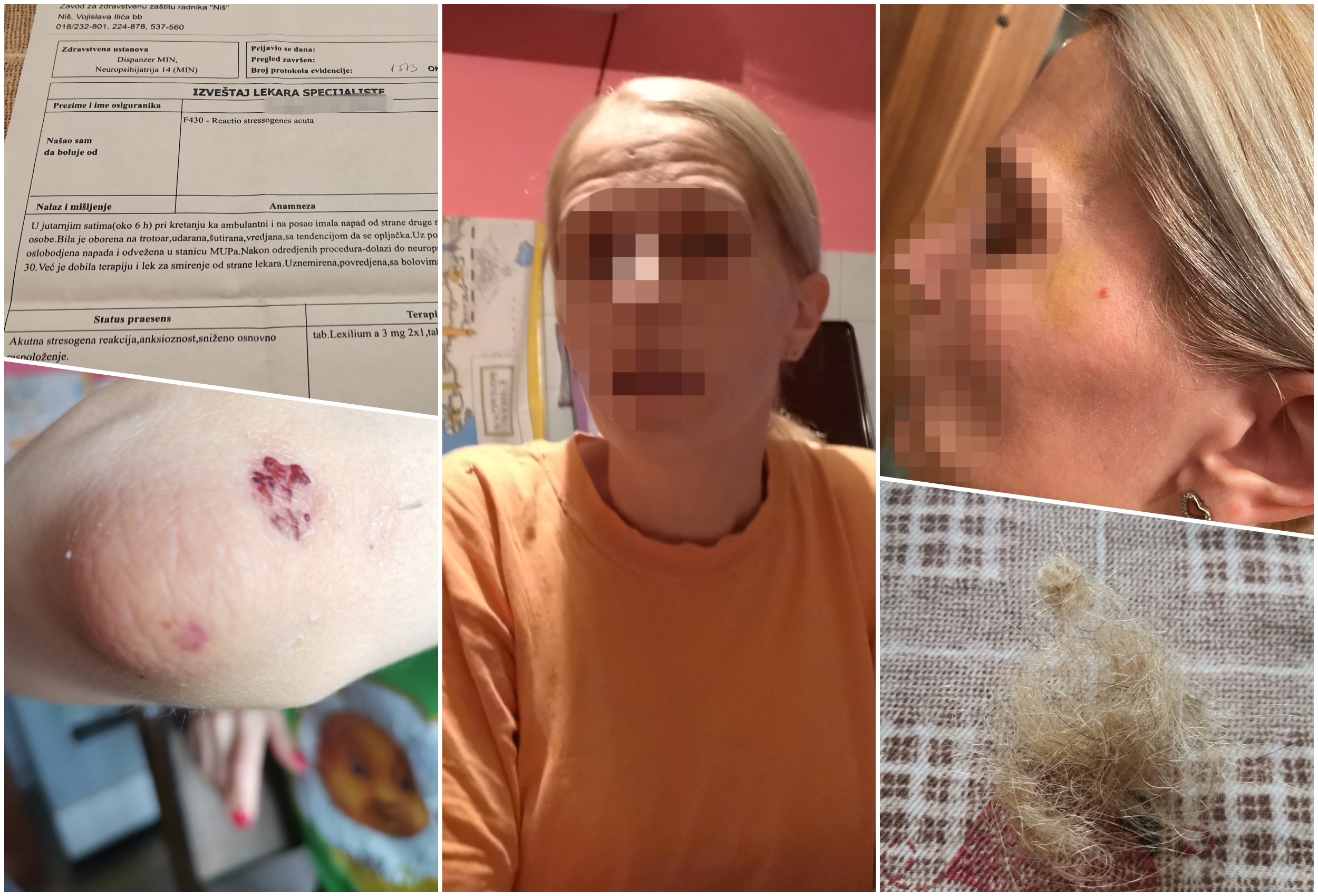 Napadnuta medicinska sestra iz Nisa