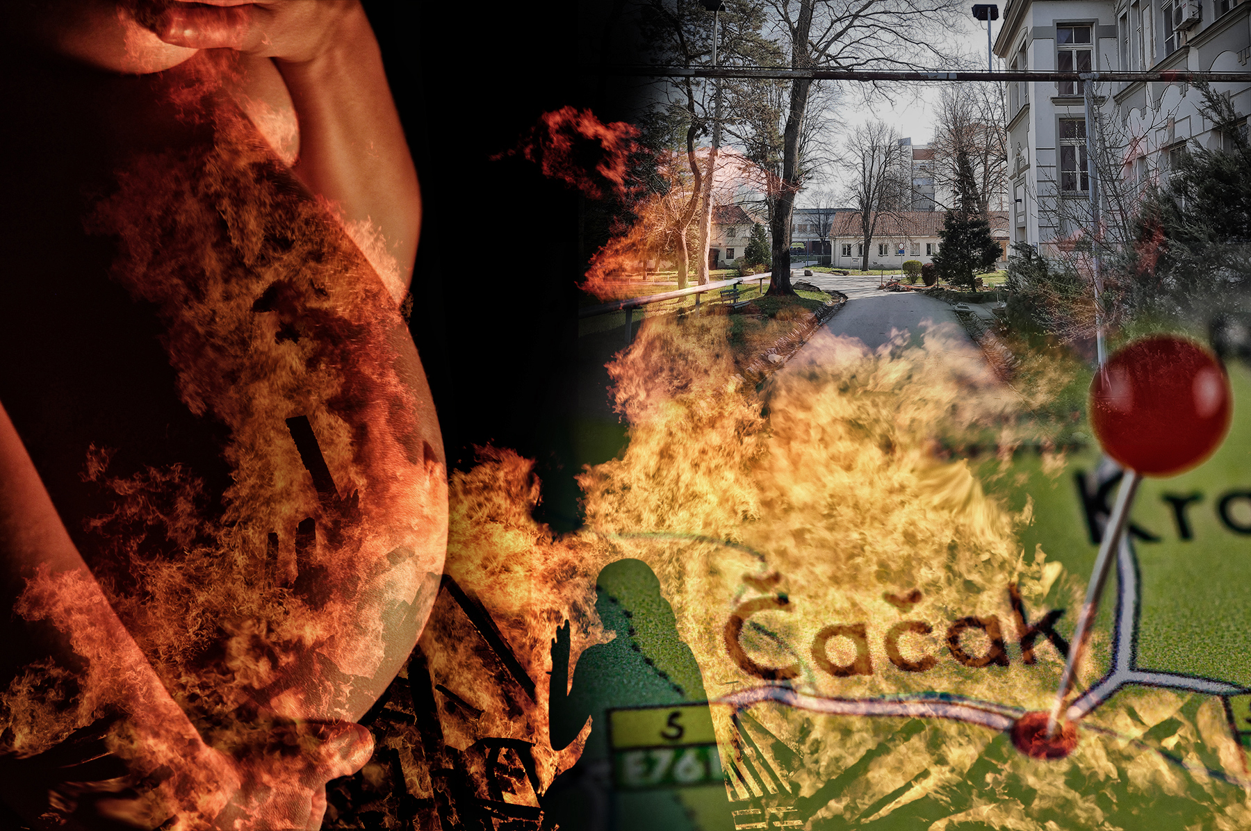 trudnica čačak zapalila se
