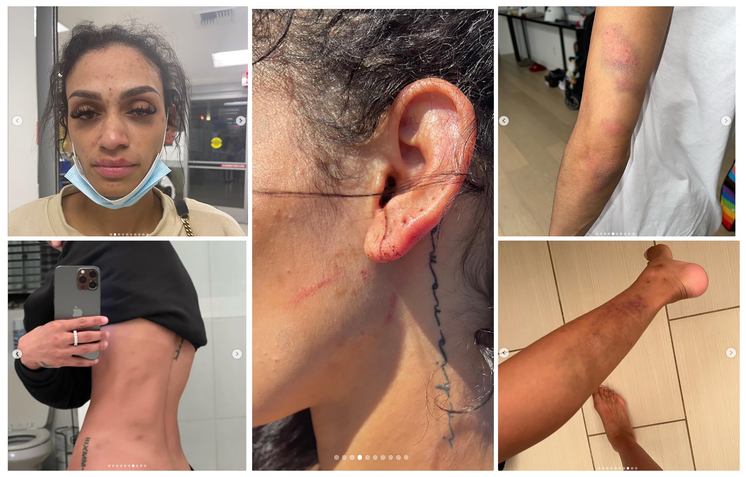 collage prebijena devojaka