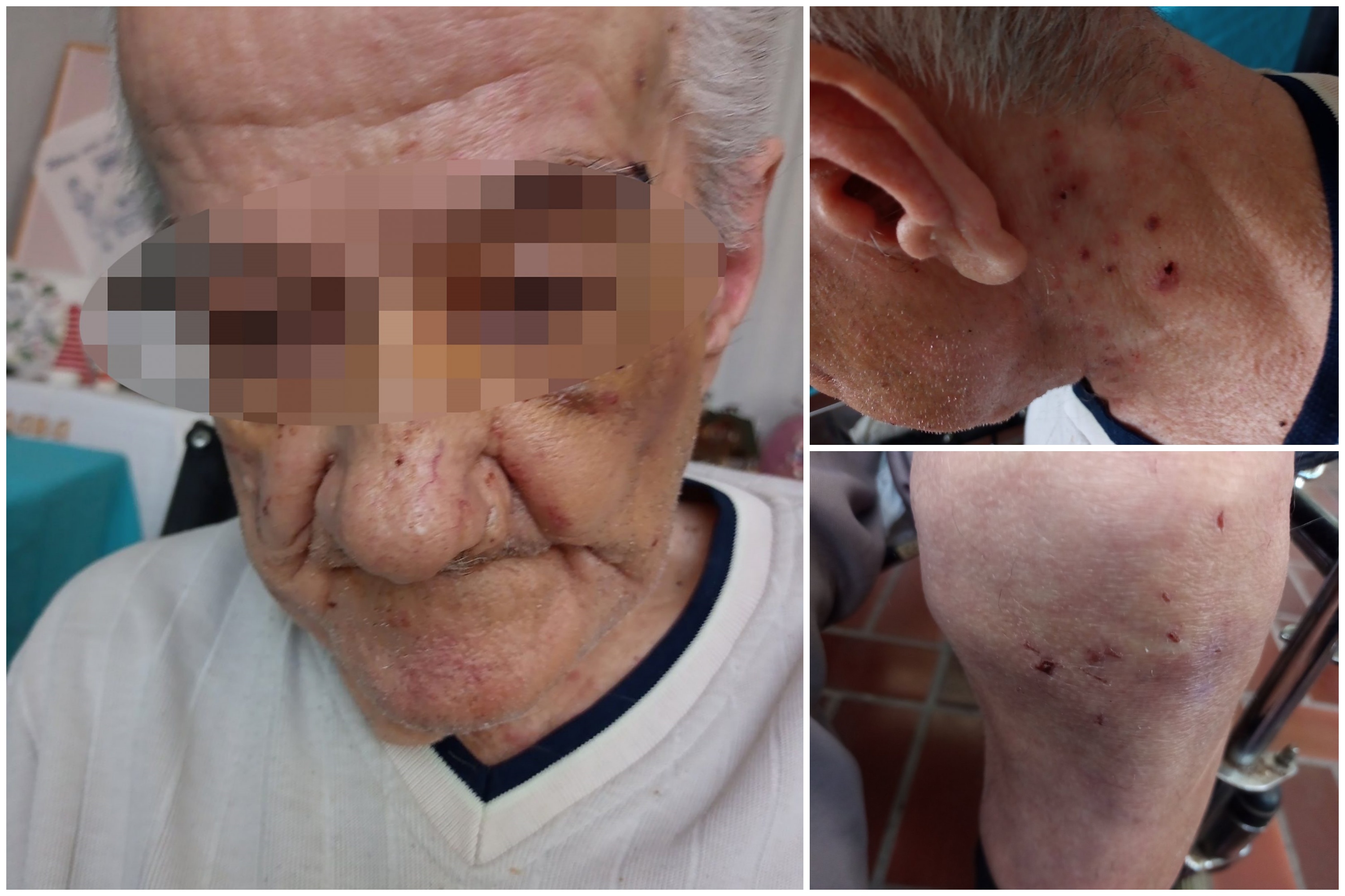 obrenovac povrede gerontoloski centar kombo