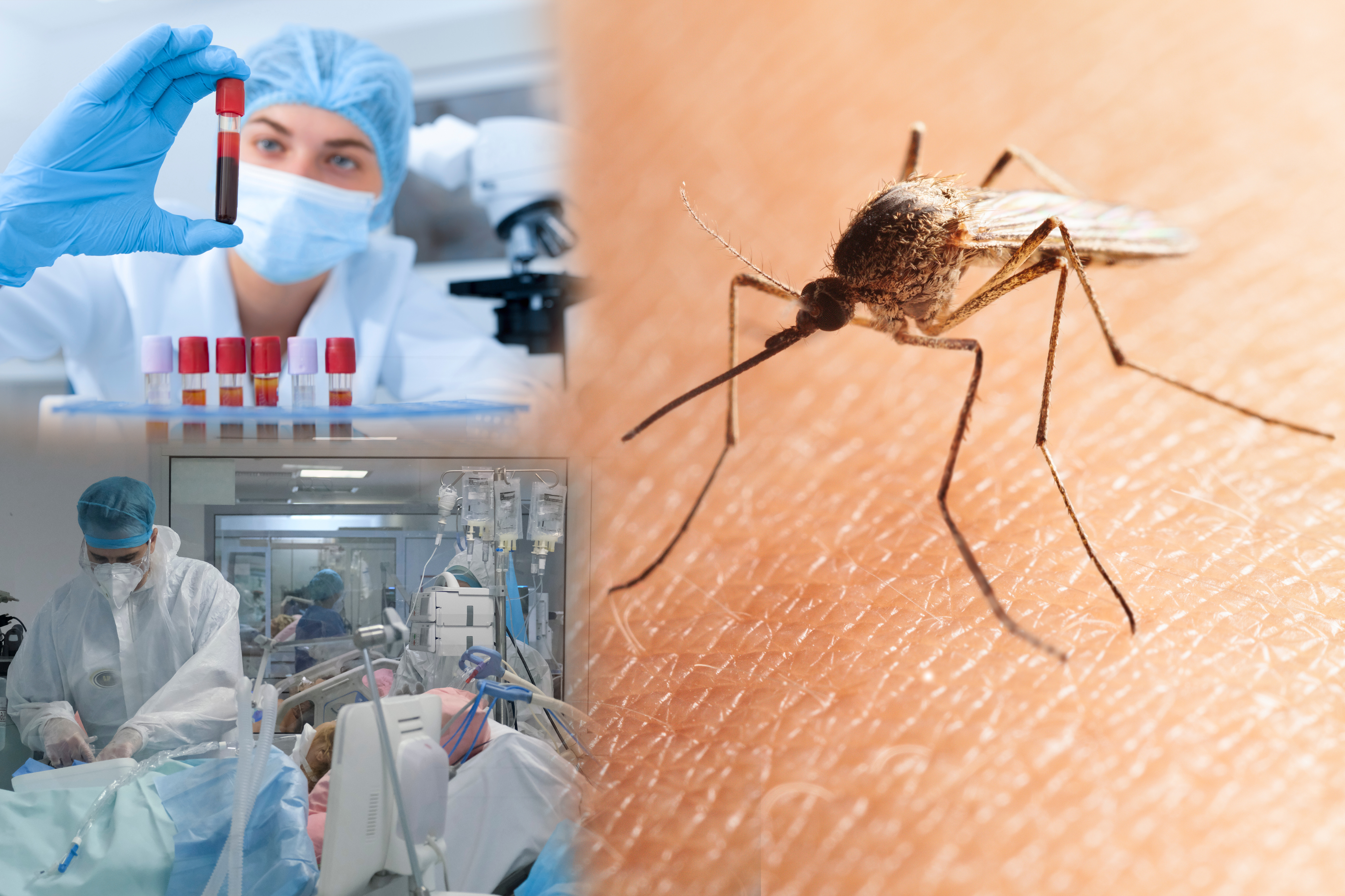 Macro,Shot,Of,Bloodsucker,Northern,House,Mosquito,(culex,Pipiens),Sitting