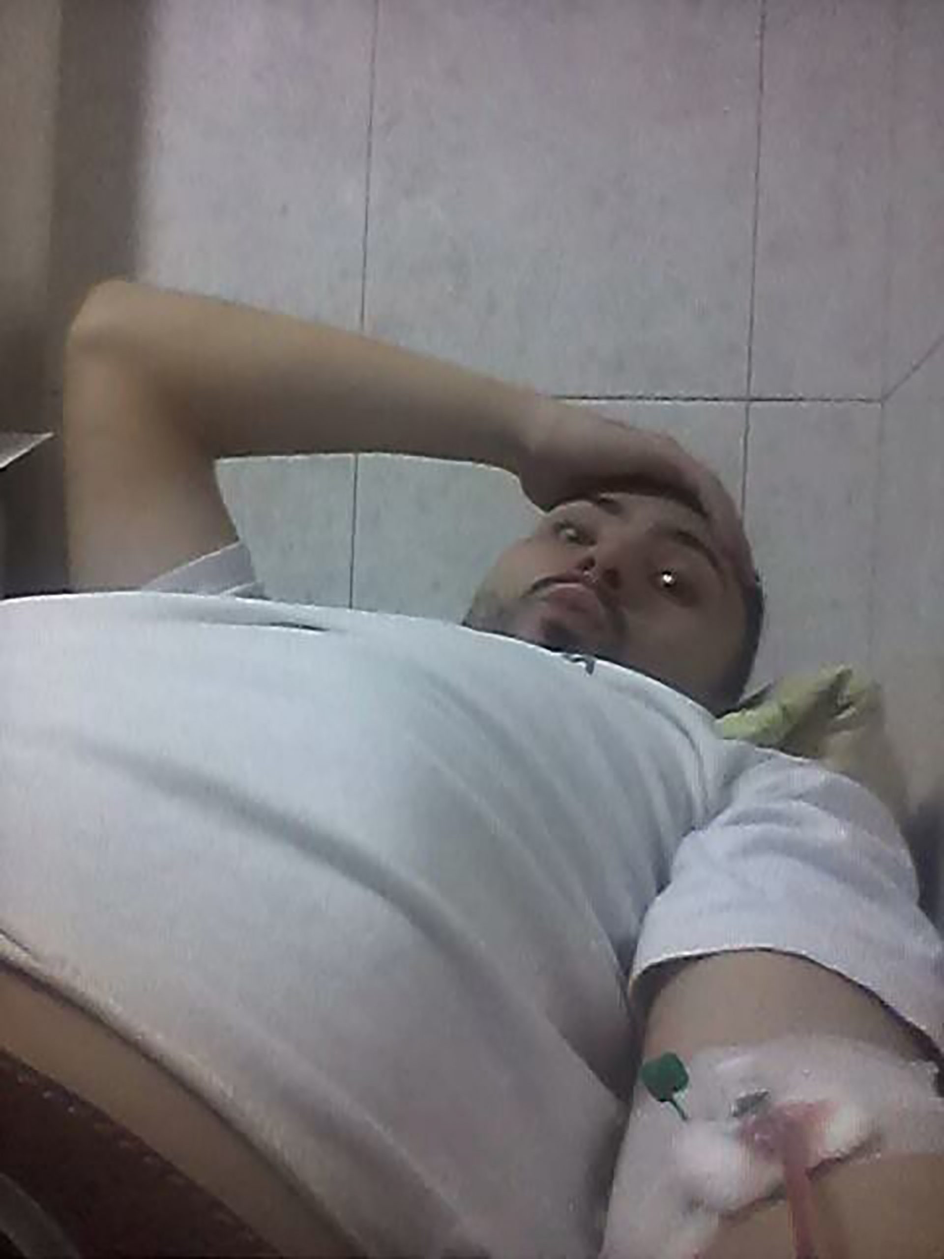 Filip Breberin, greška lekara