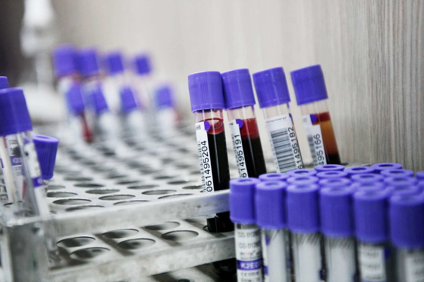 beograd 22.11.2021 dobrovoljno davanje krvi, transfuzija krvi, united media davanje krvi