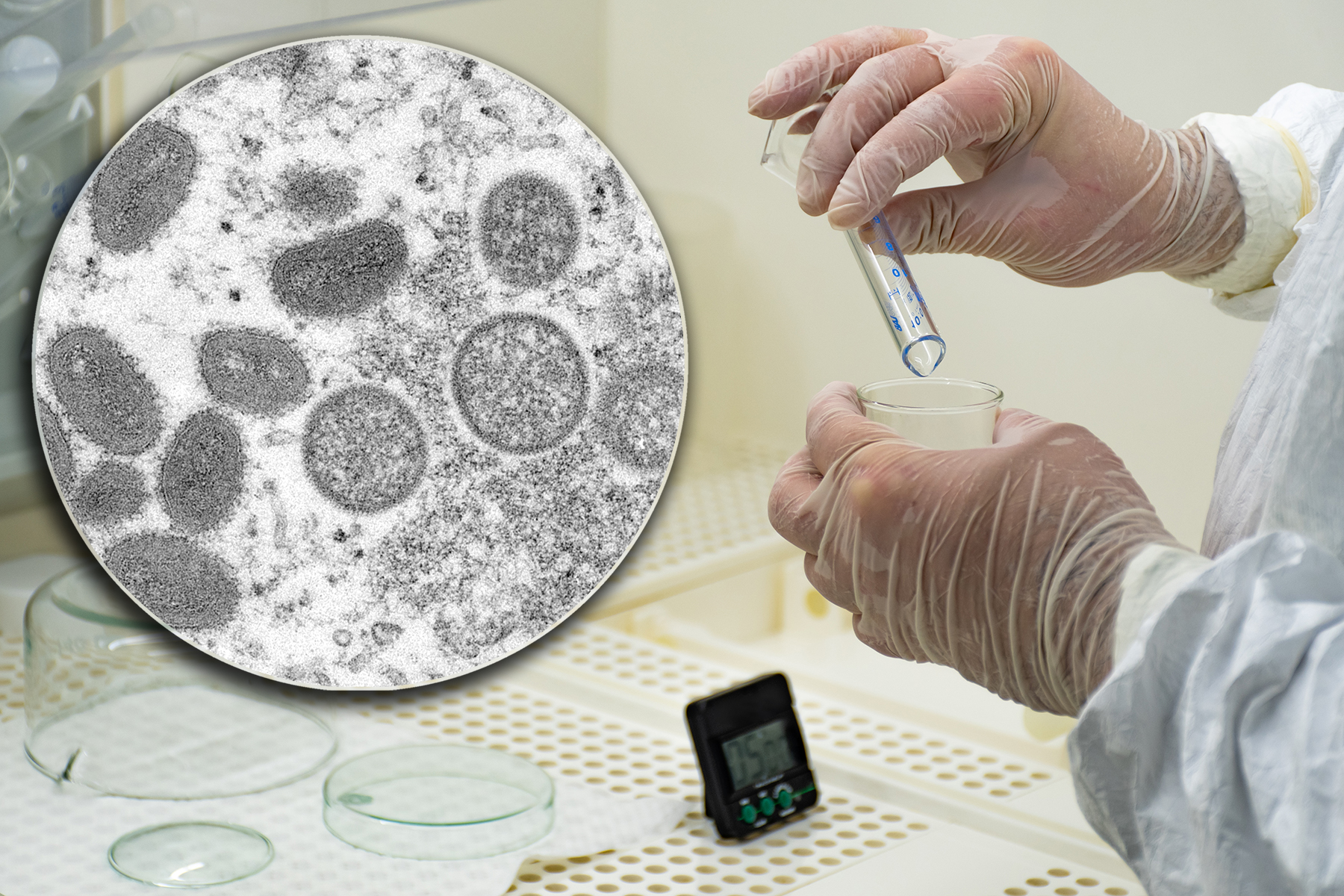 Medical test new vaccine research and development concept. Scientist in laboratory studying and analyzing scientific sample