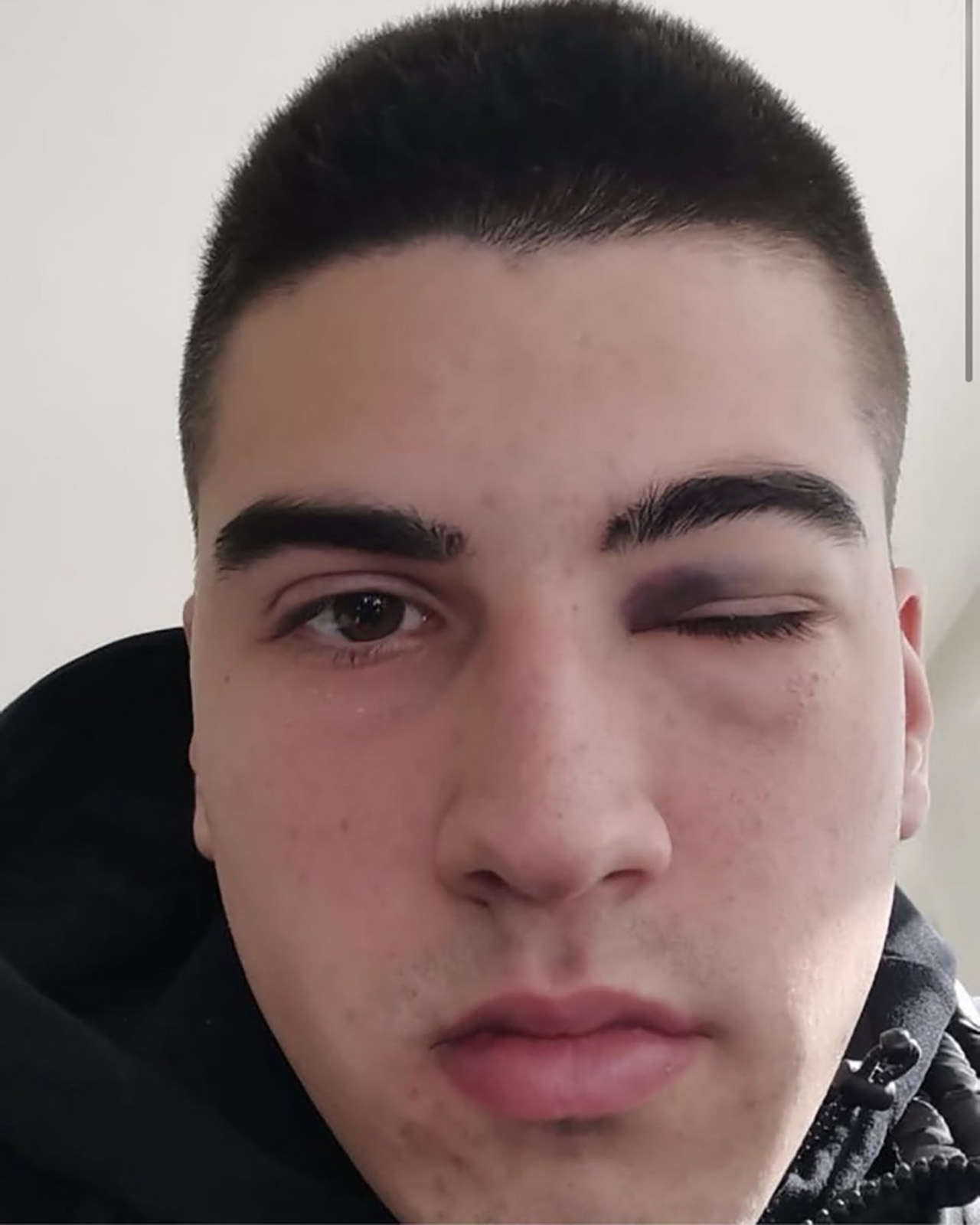 Andrija
, Pretučeni u Prijepolju