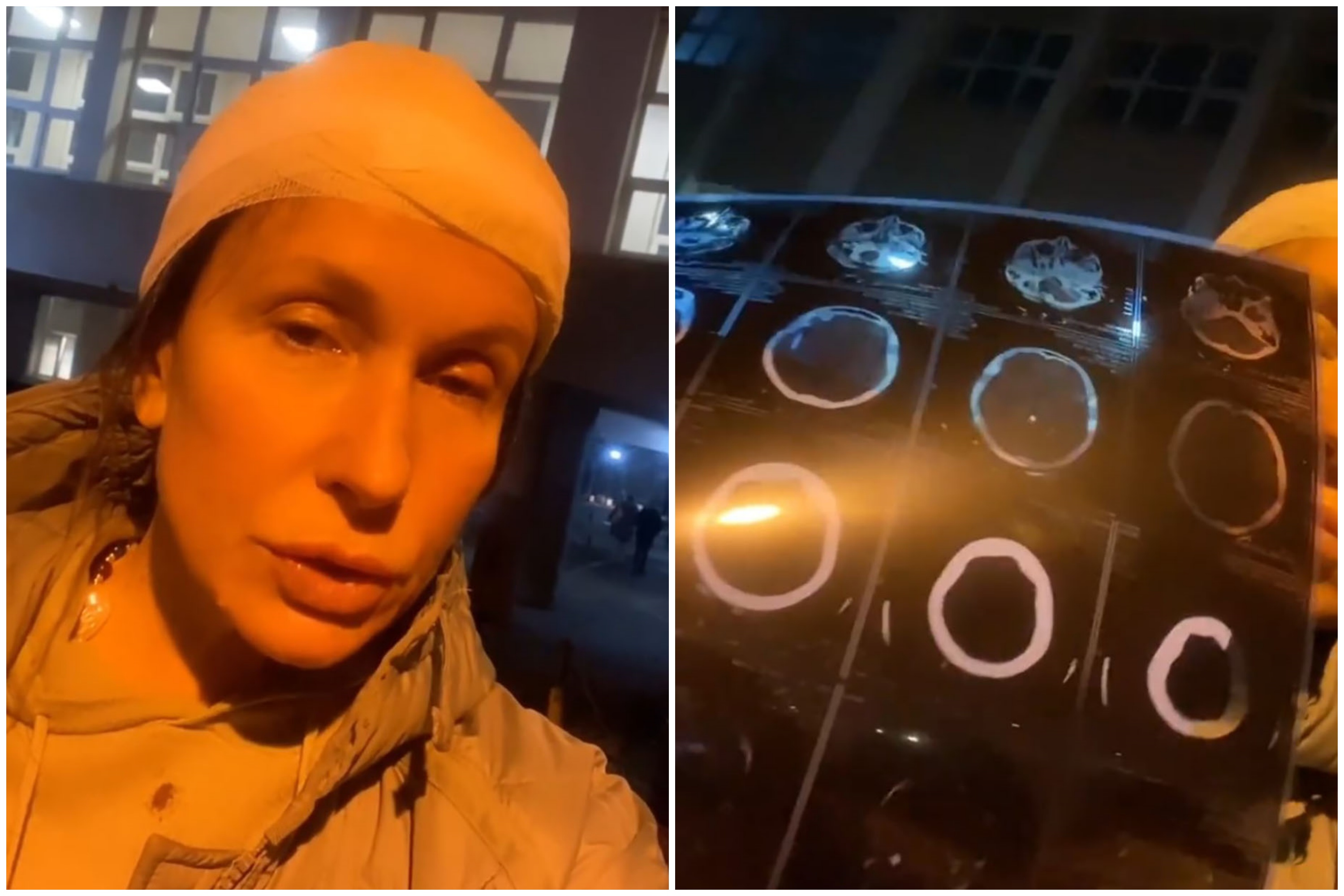 snezana dakic urgentni kamen u glavu kombo02