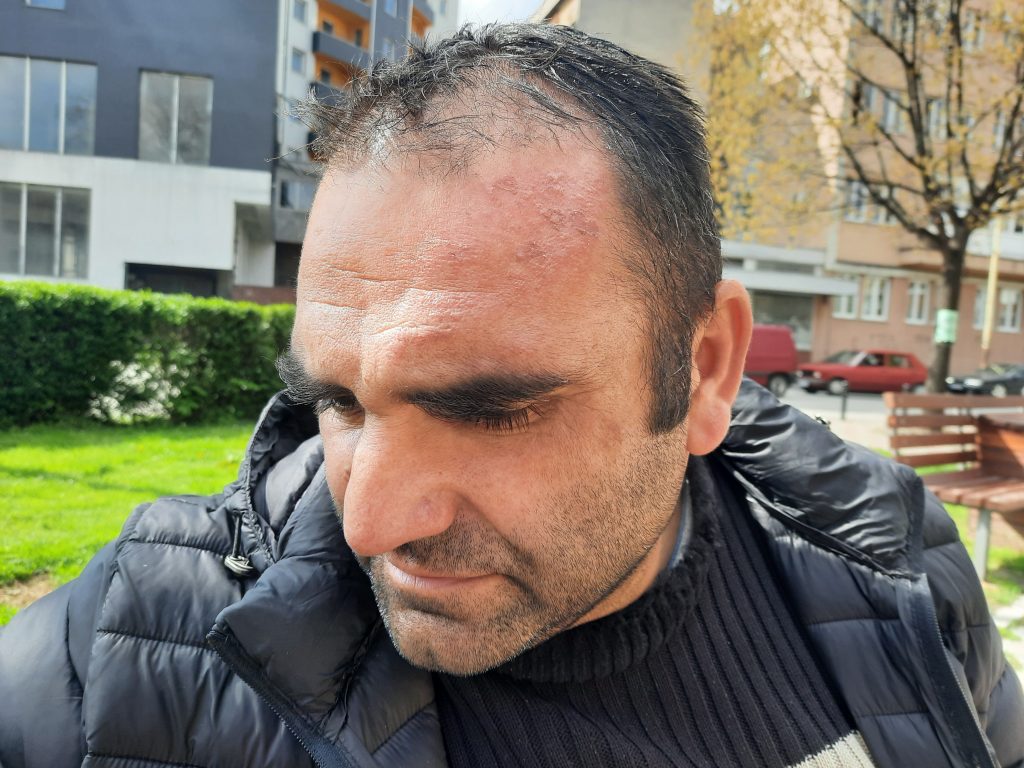 napadnut kombi koji se u subotu vraćao sa derbija,Napad se dogodio na izlazu iz Mladenovca, a u kombiju je bilo osmoro mladih iz jednog kragujevačkog sela.i vozač.  , poslala Aleksandra Petrovic