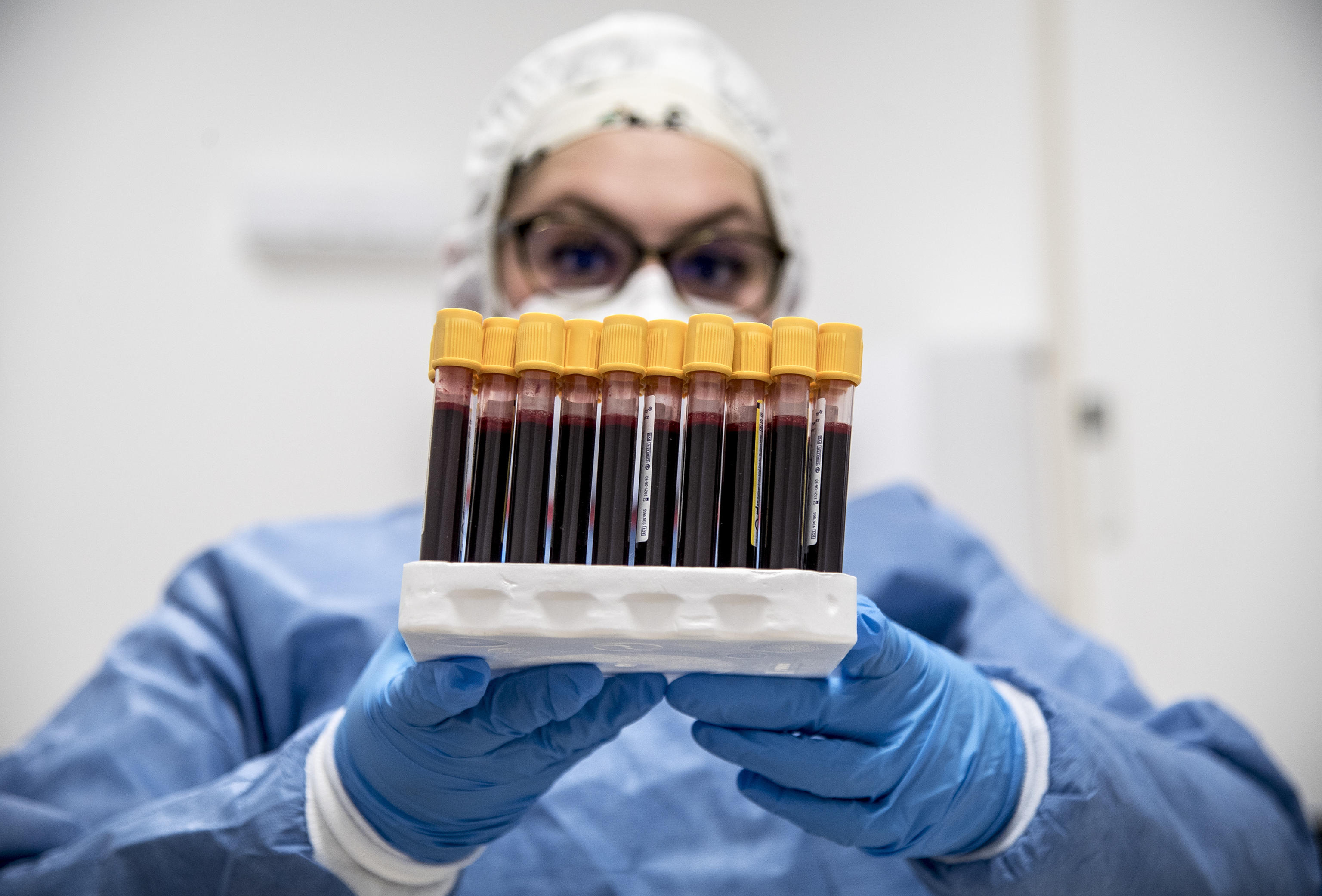 Coronavirus Testing in Italy