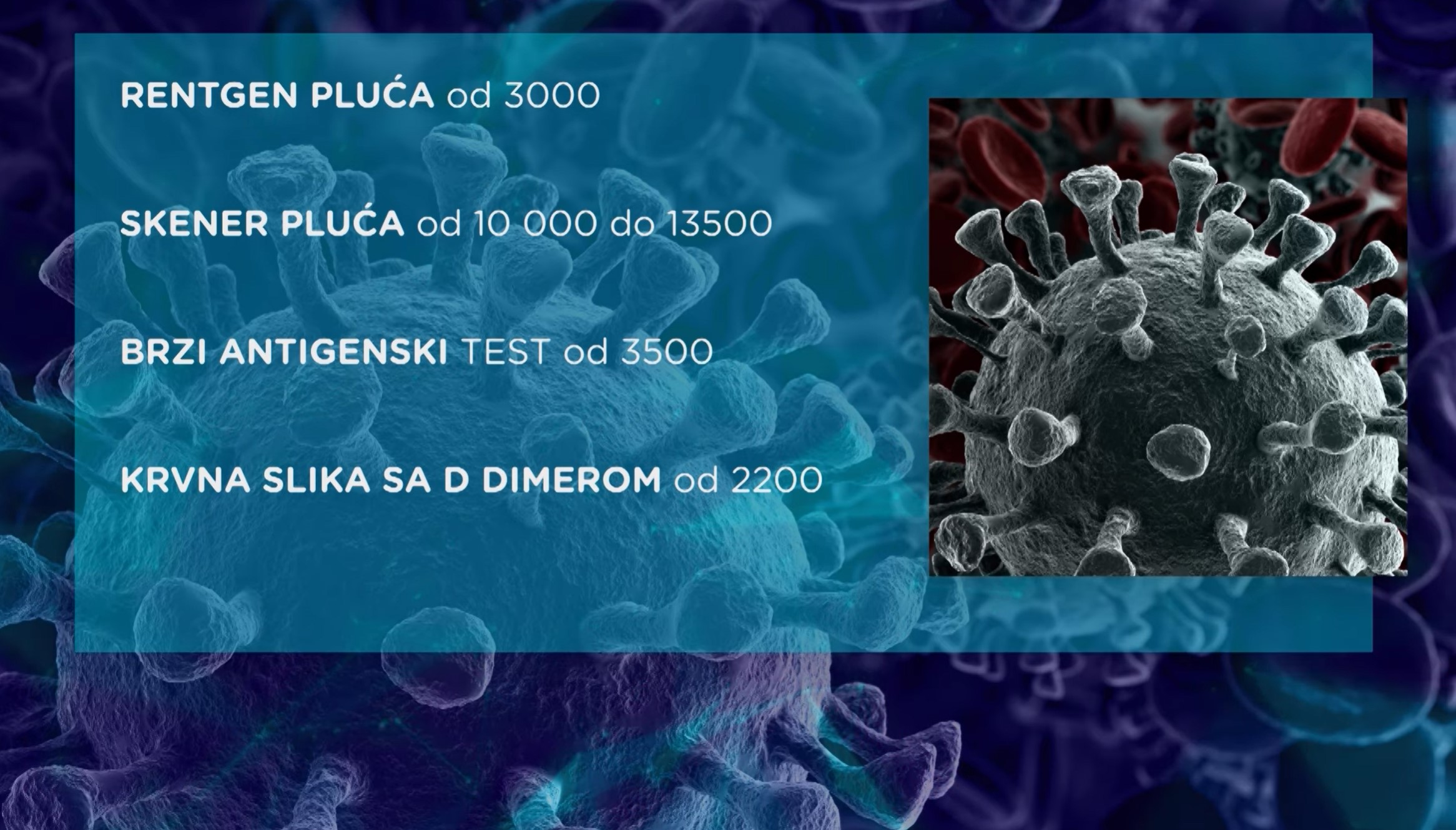Među nama, Koliko košta korona? - PKG LEČENJE KORONA