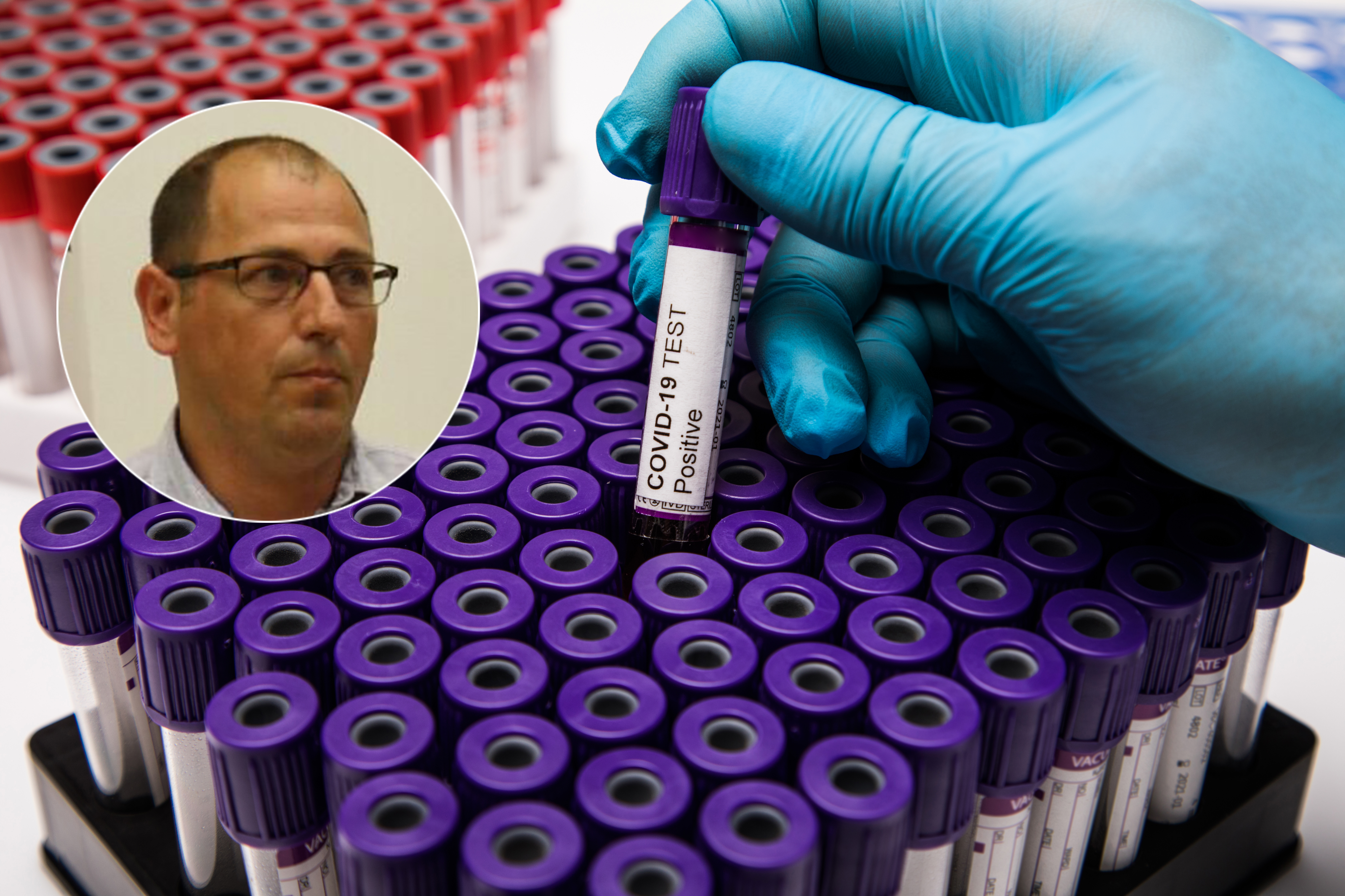 Coronavirus,Blood,Test,Concept.,Analyzing,Blood,Sample,In,Test,Tube