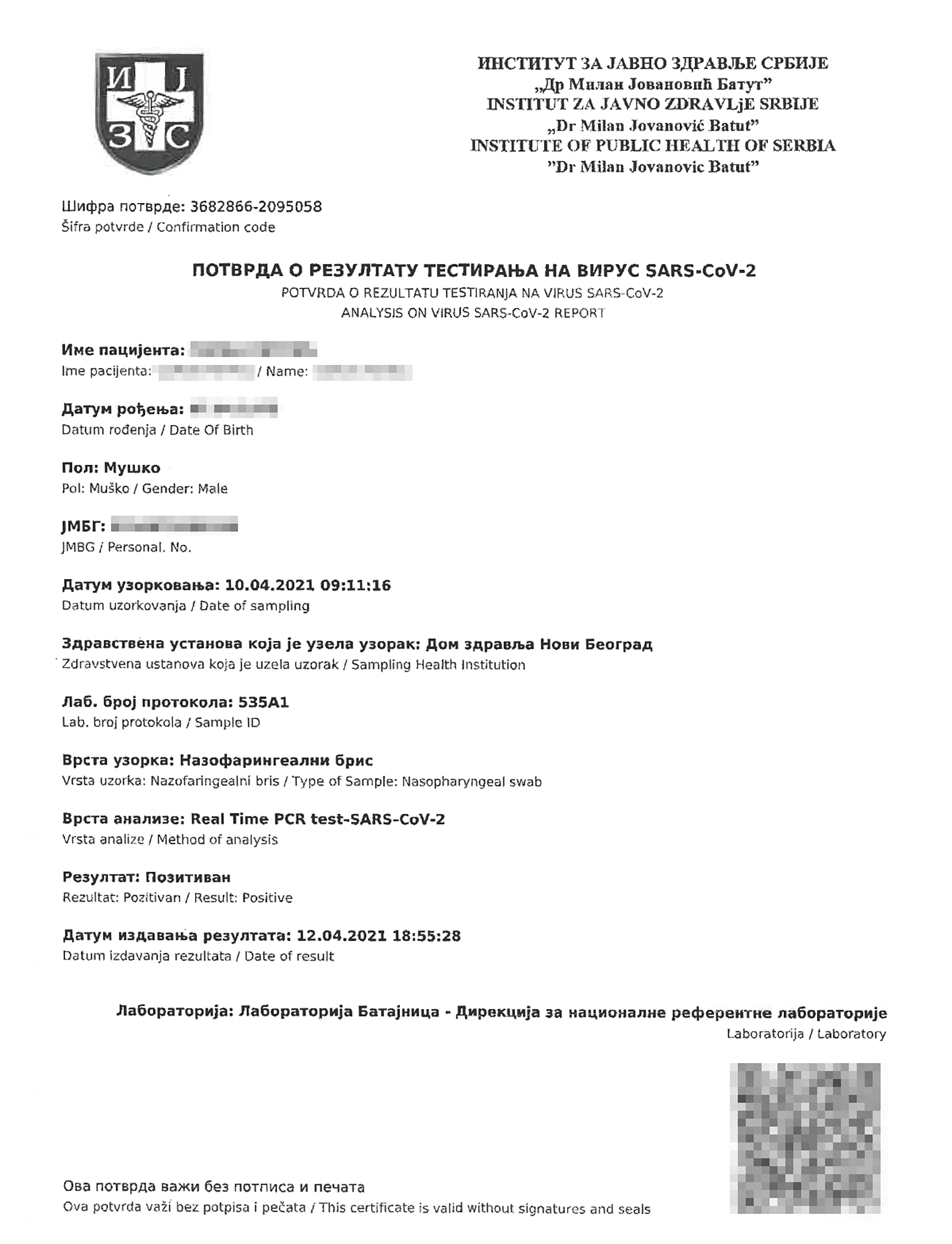 Struja korona laboratorijske analize