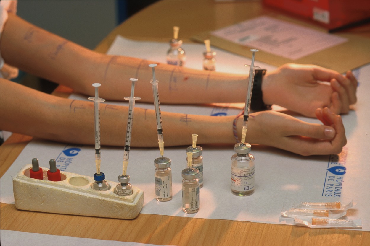 Rotschild Hospital.Allergic to antibiotic,Image: 41285404, License: Rights-managed, Restrictions: , Model Release: yes, Credit line: ASTIER / BSIP / Profimedia