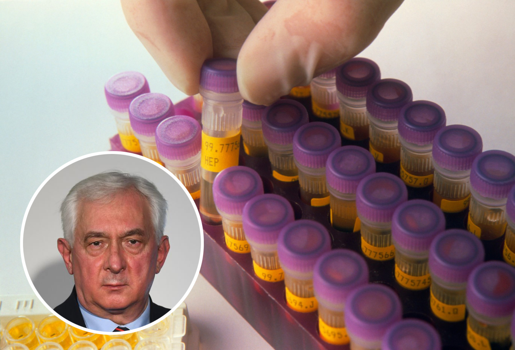 Monolisa EIA test for hepatitis C virus antibodies